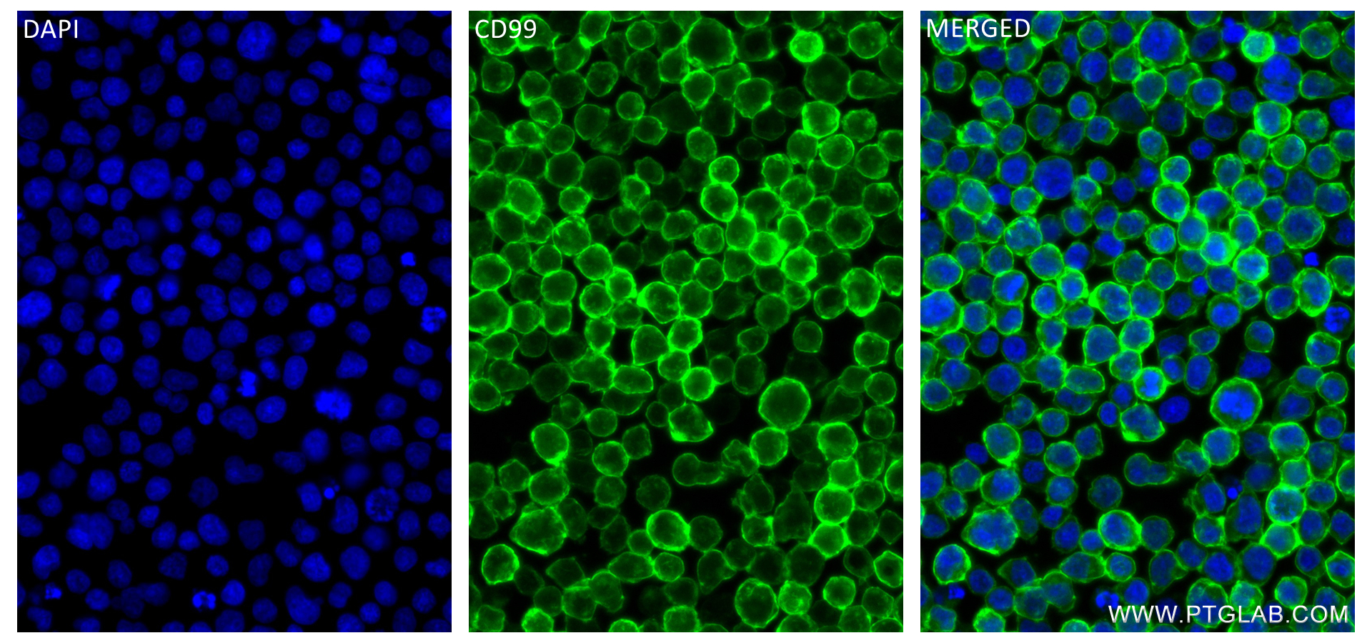 IF Staining of Jurkat using 84580-4-RR (same clone as 84580-4-PBS)