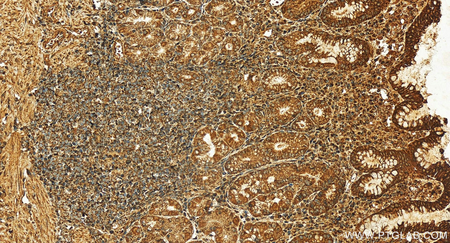 IHC staining of human stomach using 28178-1-AP