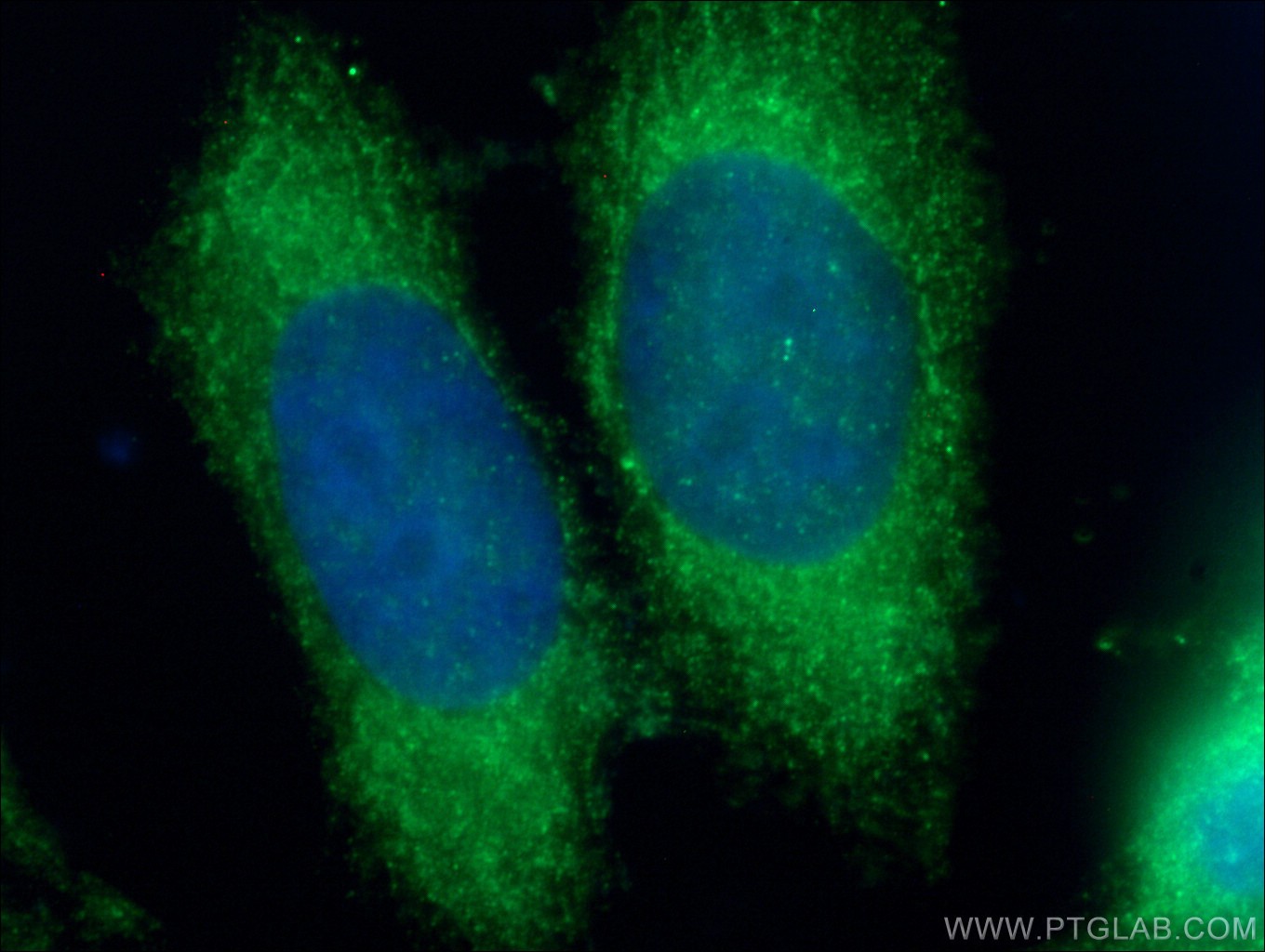 IF Staining of HeLa using 13376-1-AP (same clone as 13376-1-PBS)