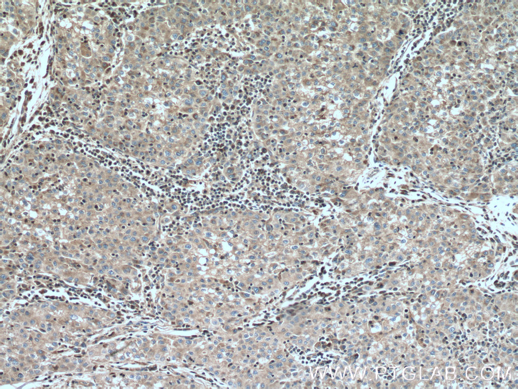 IHC staining of human kidney using 13376-1-AP (same clone as 13376-1-PBS)