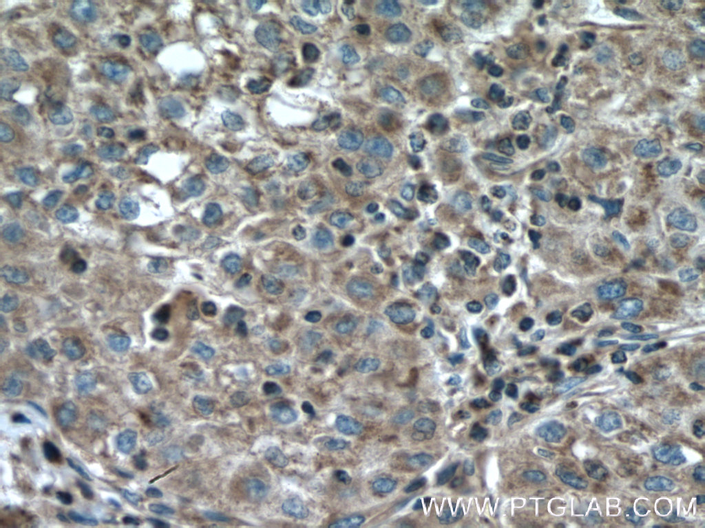 IHC staining of human kidney using 13376-1-AP (same clone as 13376-1-PBS)