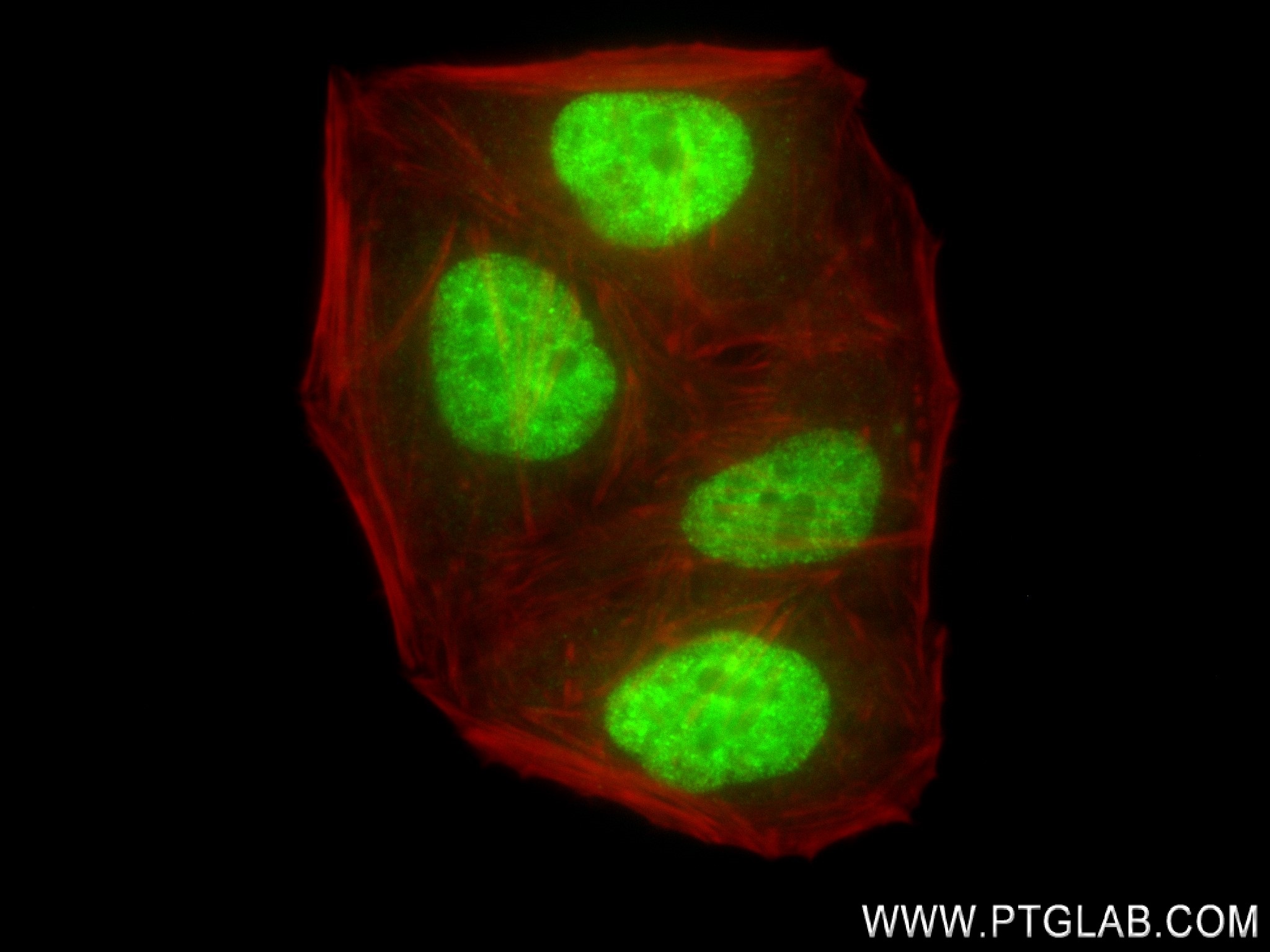 IF Staining of HepG2 using 84145-2-RR (same clone as 84145-2-PBS)