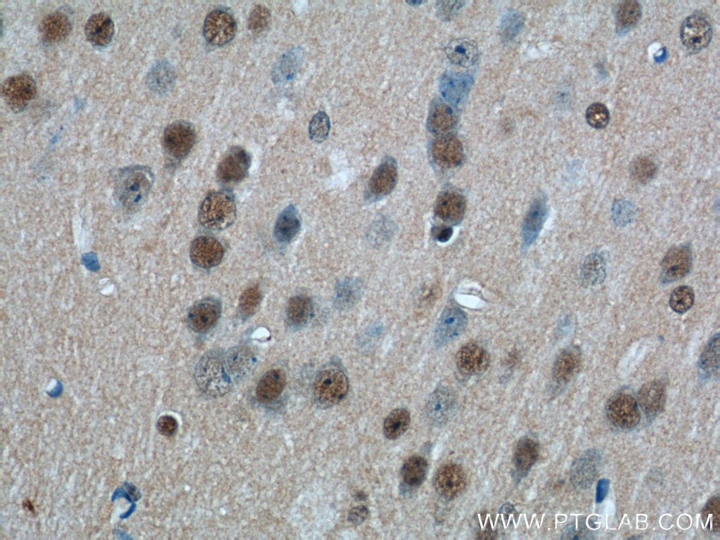 IHC staining of mouse brain using 14125-1-AP