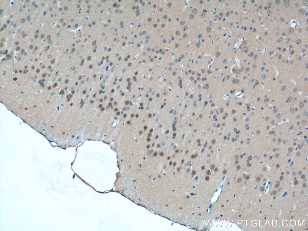 IHC staining of mouse brain using 14125-1-AP