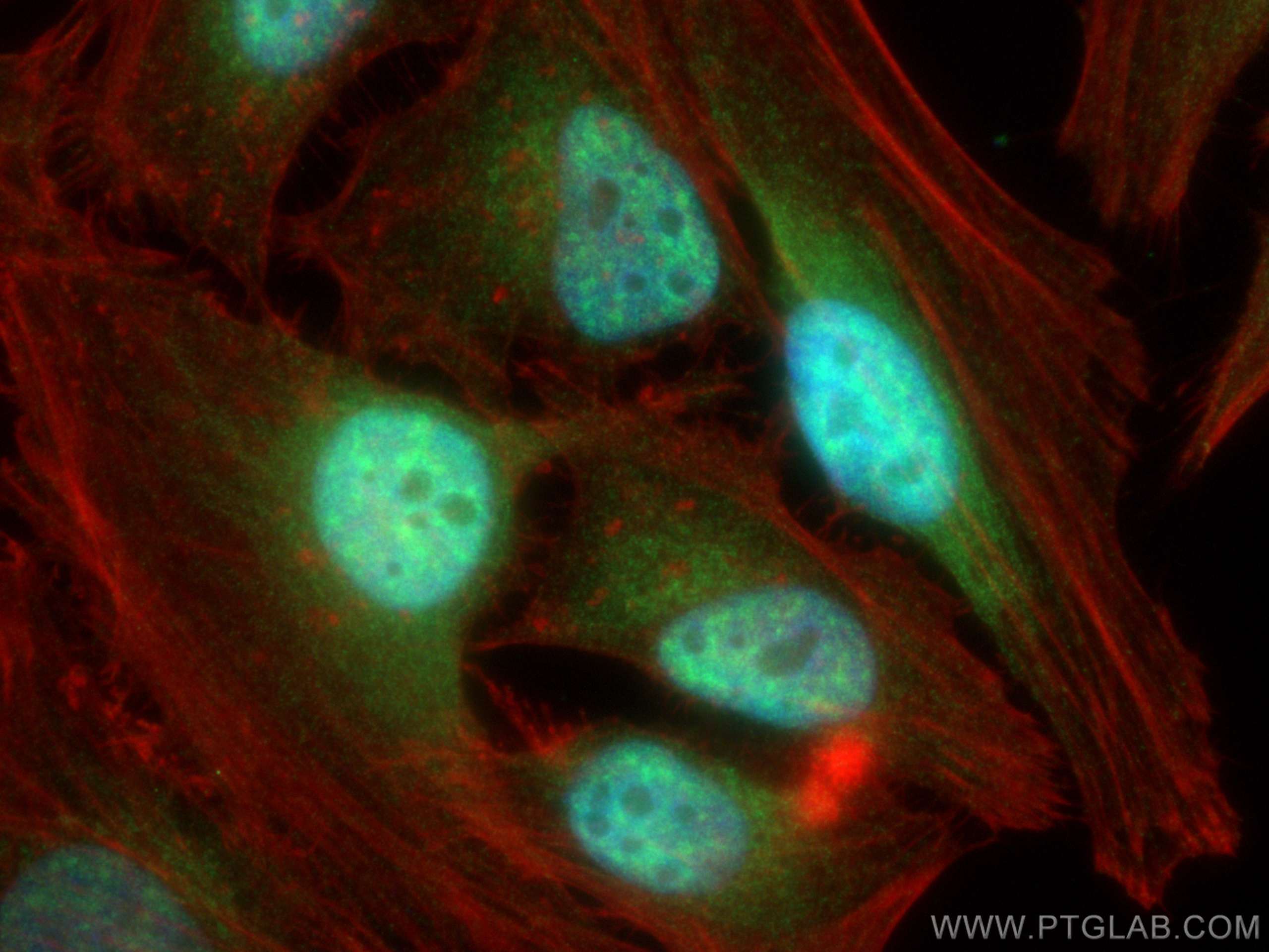 IF Staining of HeLa using 28613-1-AP