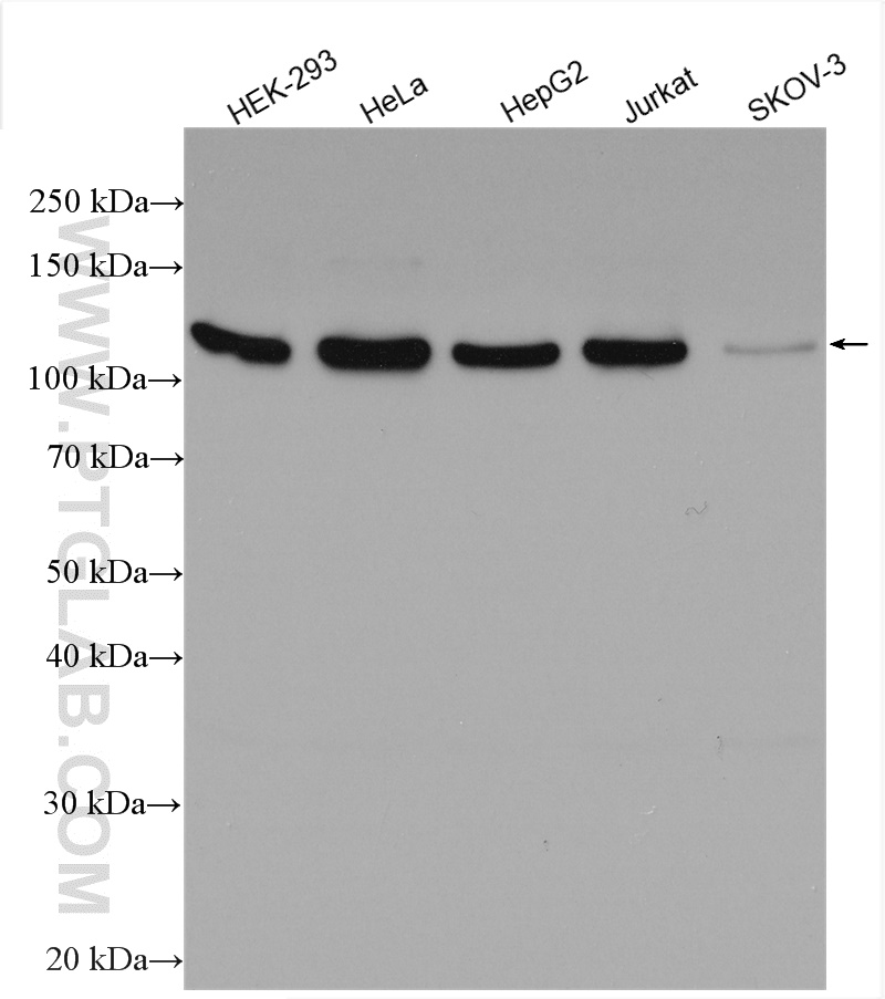 WB analysis using 28613-1-AP