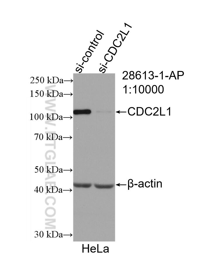 WB analysis of HeLa using 28613-1-AP