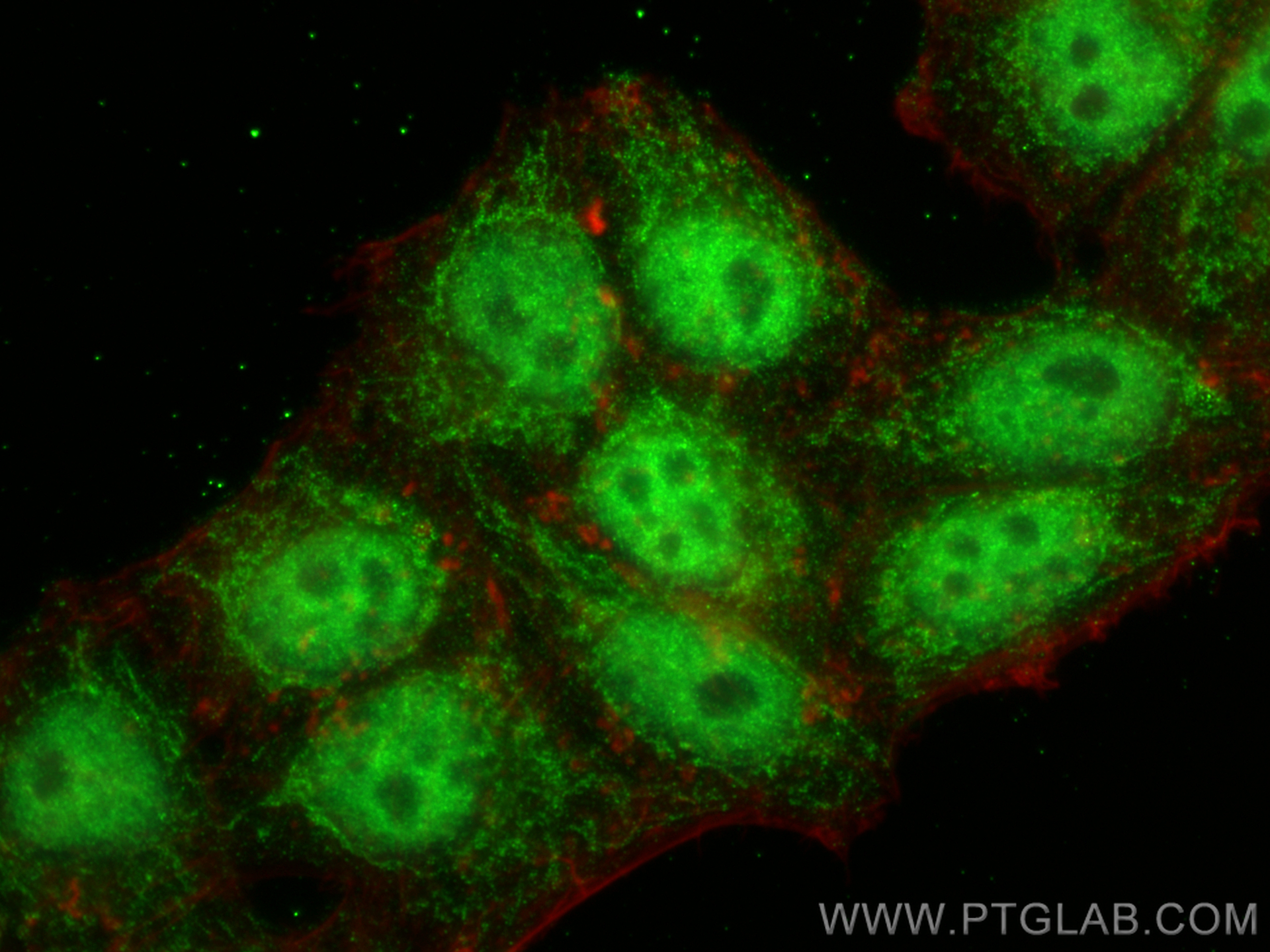 IF Staining of HepG2 using 12974-1-AP