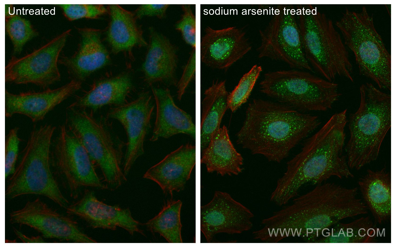 IF Staining of HeLa using 66021-1-Ig (same clone as 66021-1-PBS)