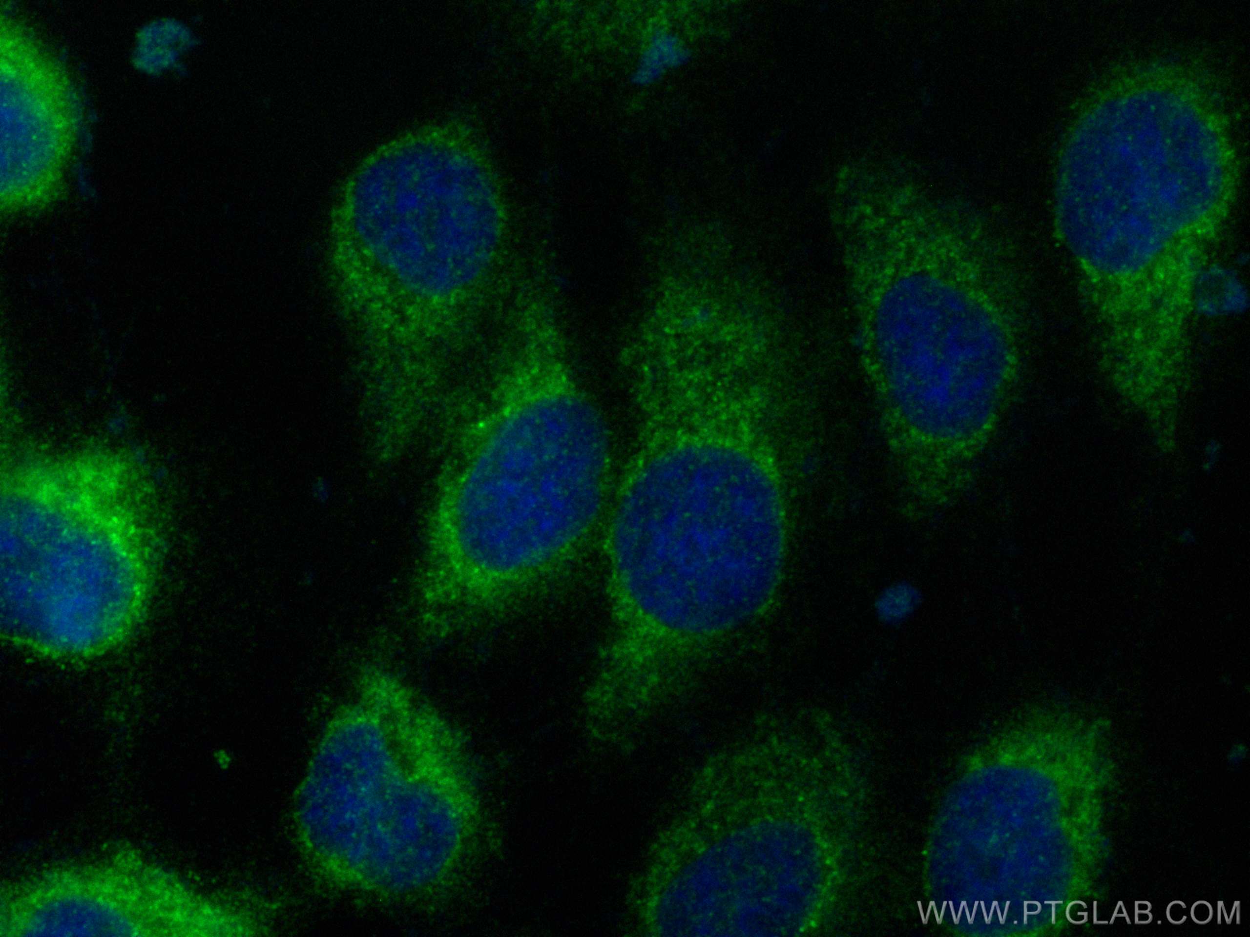 IF Staining of A431 using 15594-1-AP