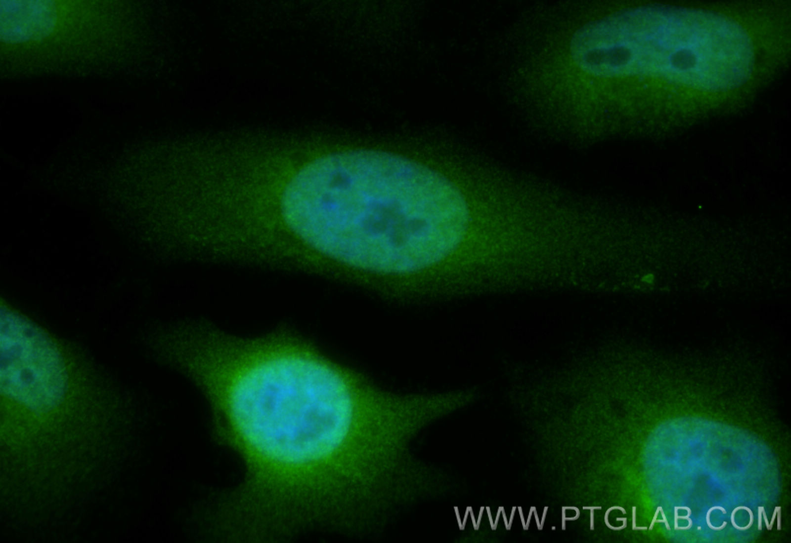 IF Staining of HeLa using 29316-1-AP