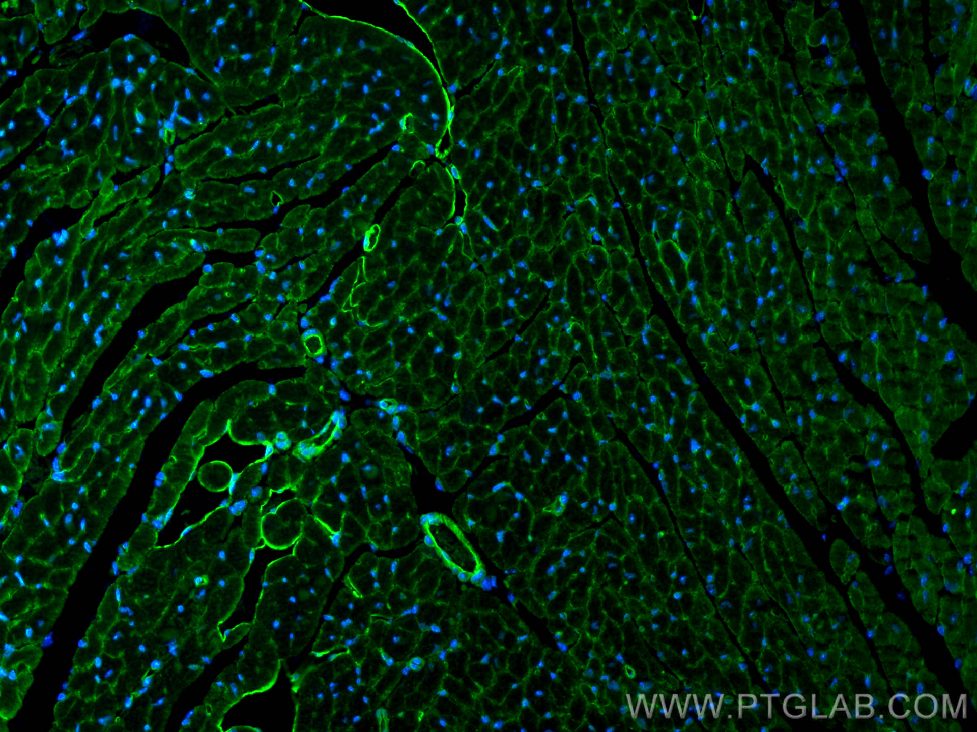 IF Staining of mouse heart using 12618-1-AP