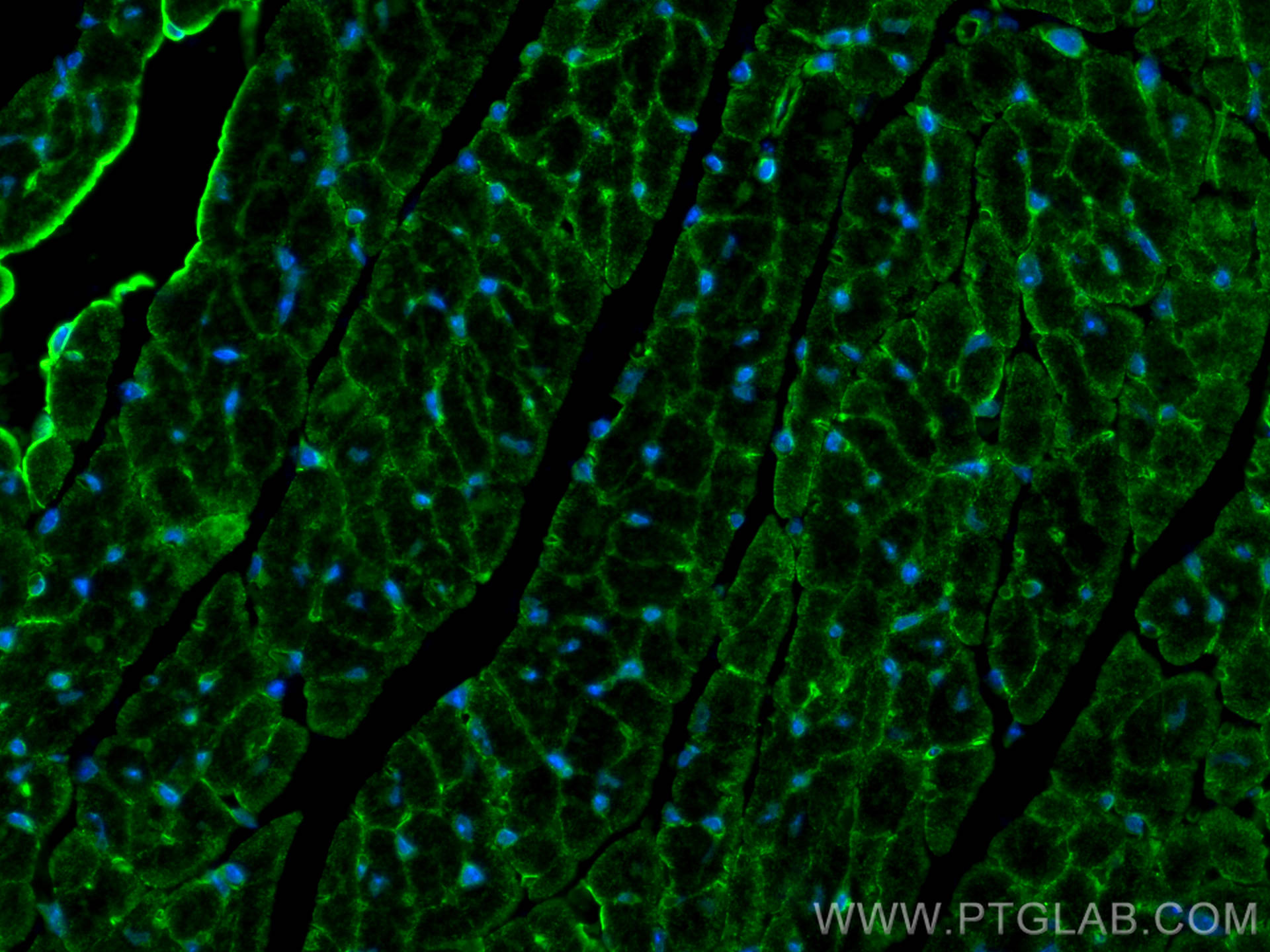 IF Staining of mouse heart using 12618-1-AP