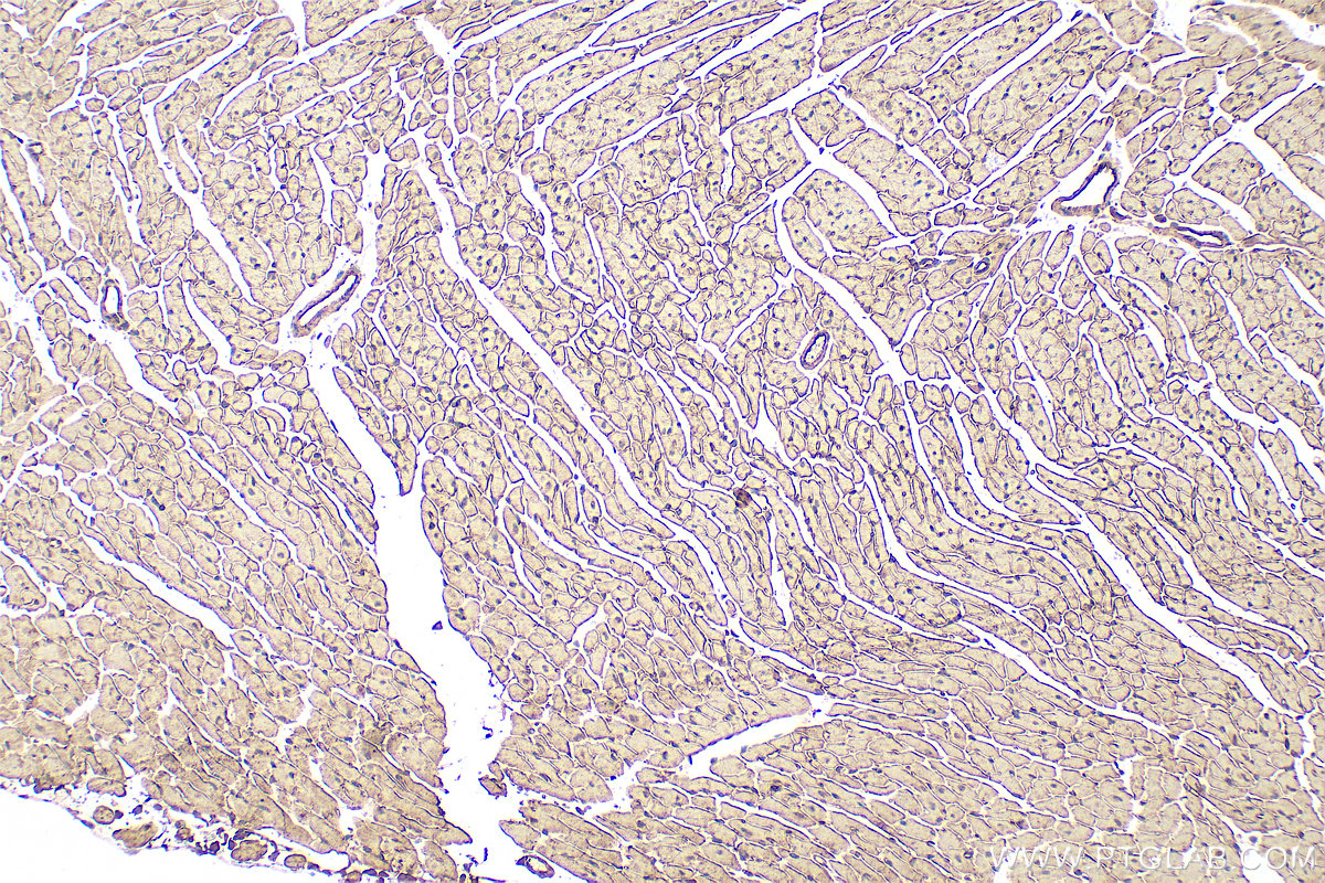 IHC staining of mouse heart using 12618-1-AP