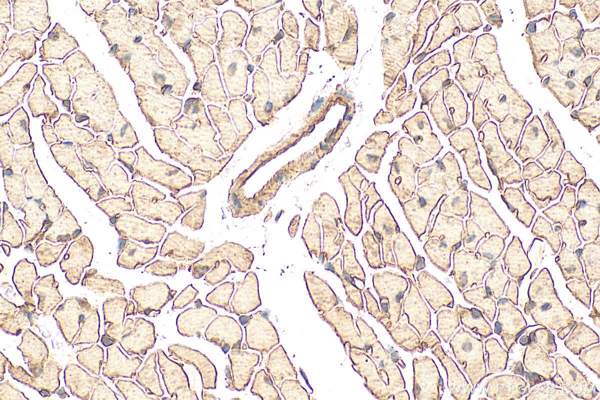 IHC staining of mouse heart using 12618-1-AP