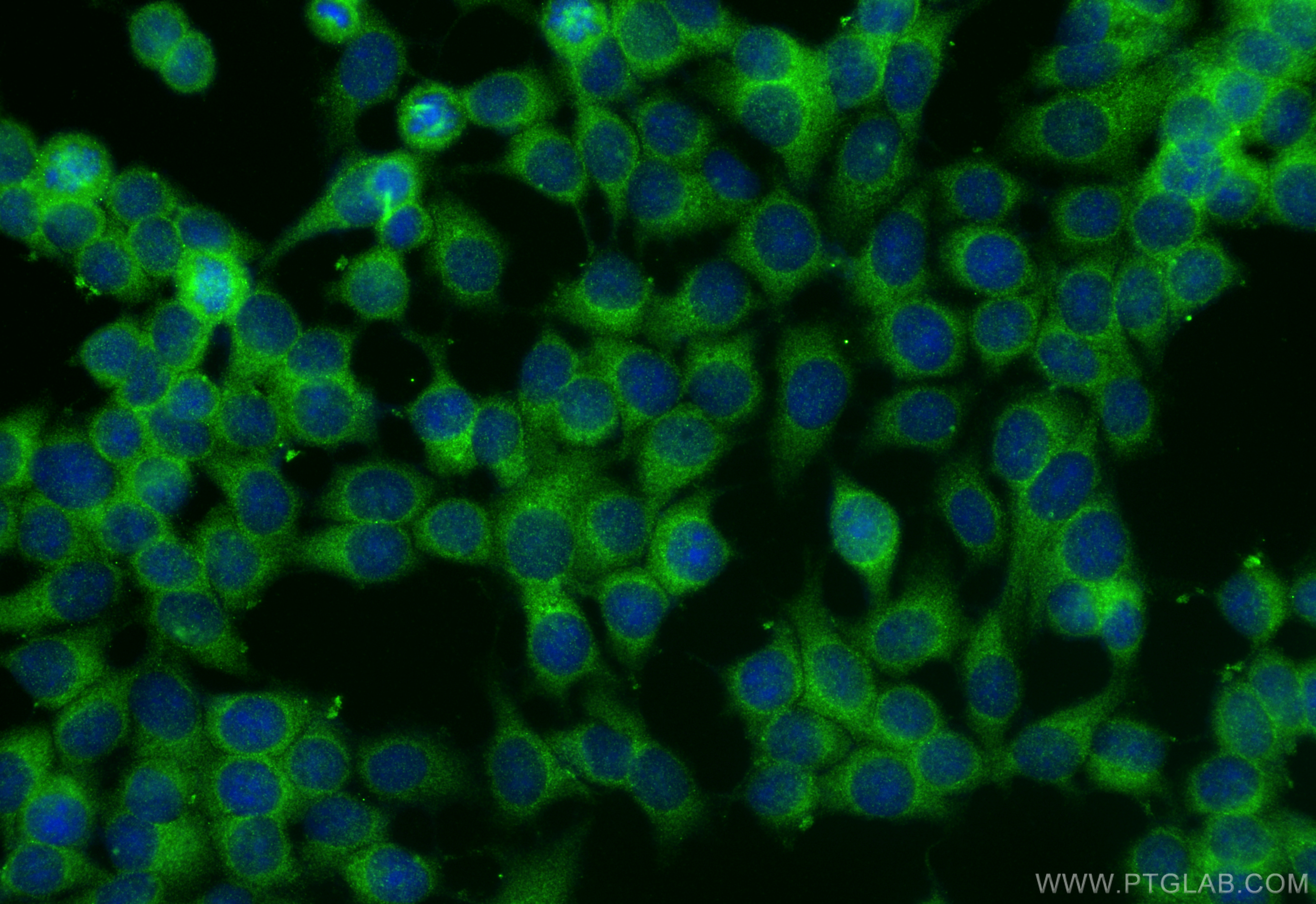 IF Staining of MCF-7 using 20057-1-AP