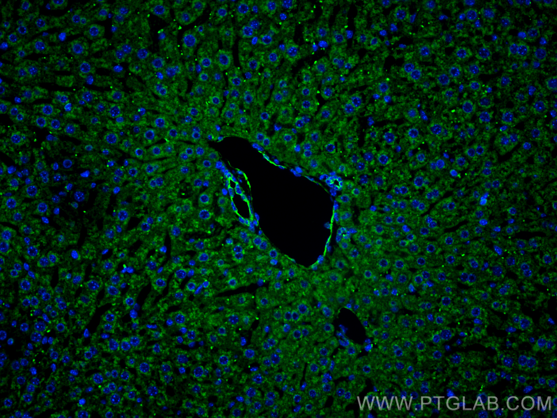 IF Staining of mouse liver using 20057-1-AP