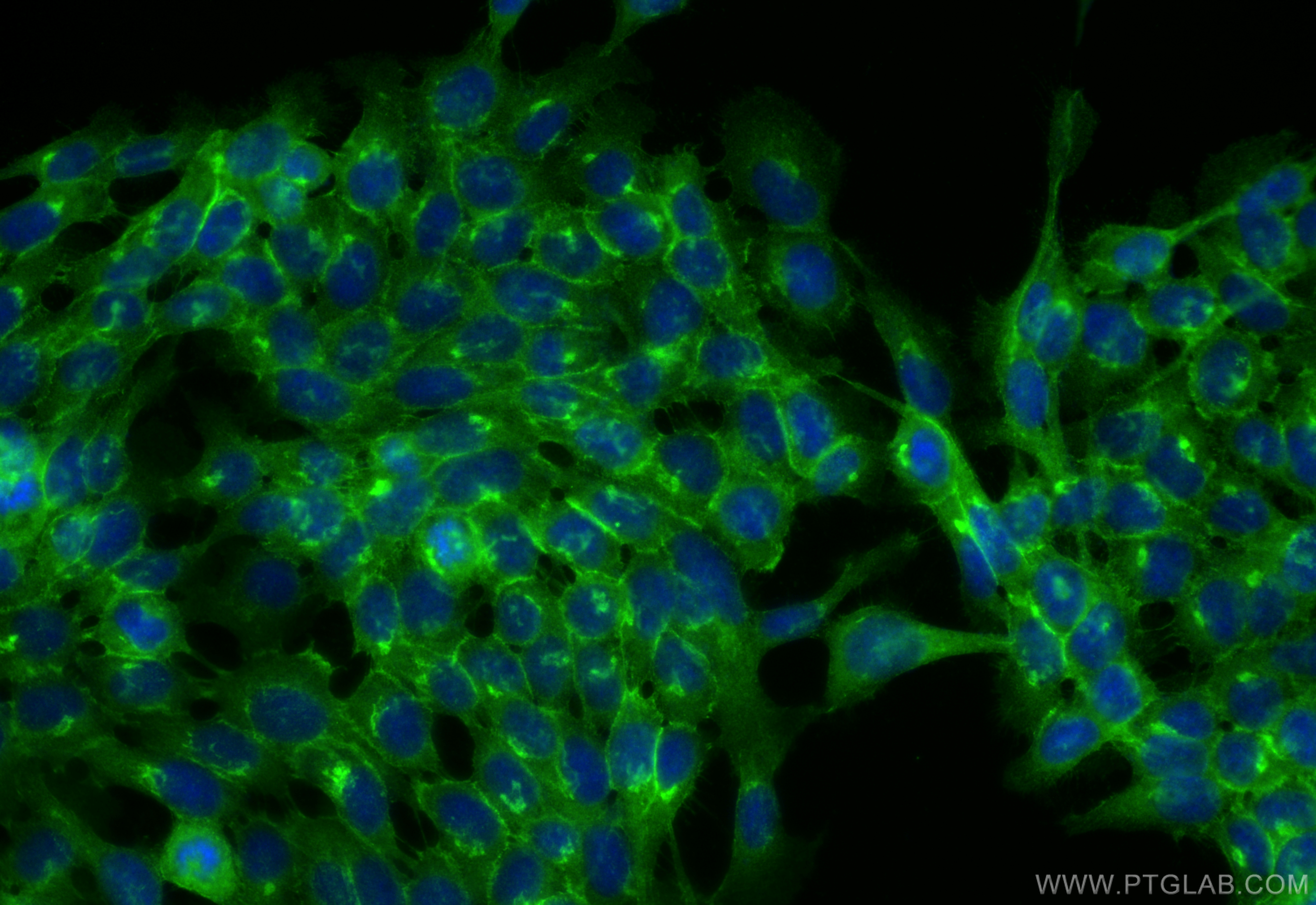 IF Staining of A431 using 13773-1-AP