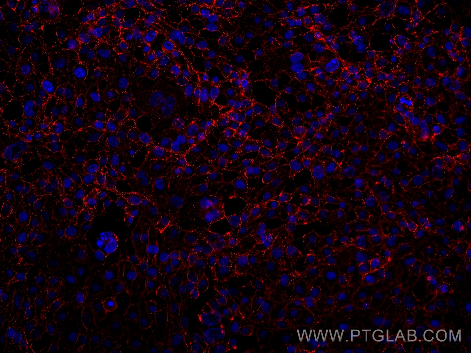 IF Staining of HUVEC using 66804-1-Ig (same clone as 66804-1-PBS)