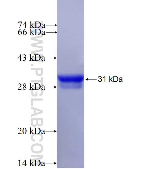 CDH6 fusion protein Ag26756 SDS-PAGE