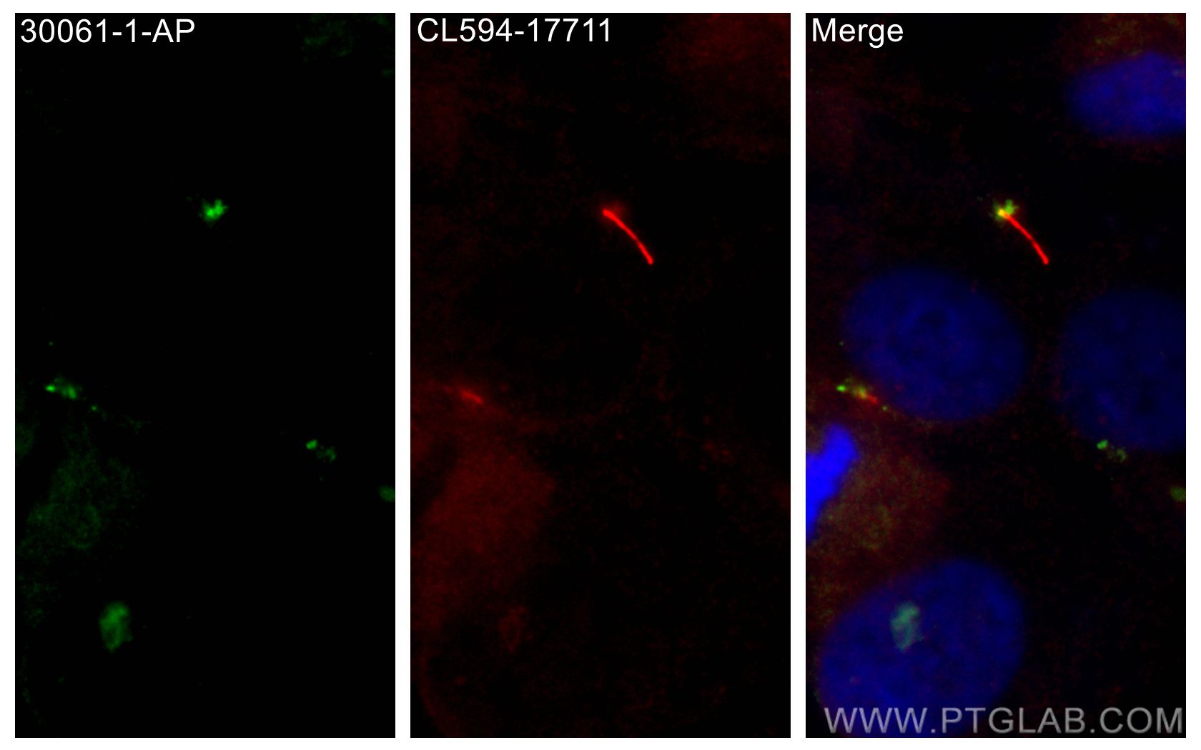 IF Staining of hTERT-RPE1 using 30061-1-AP