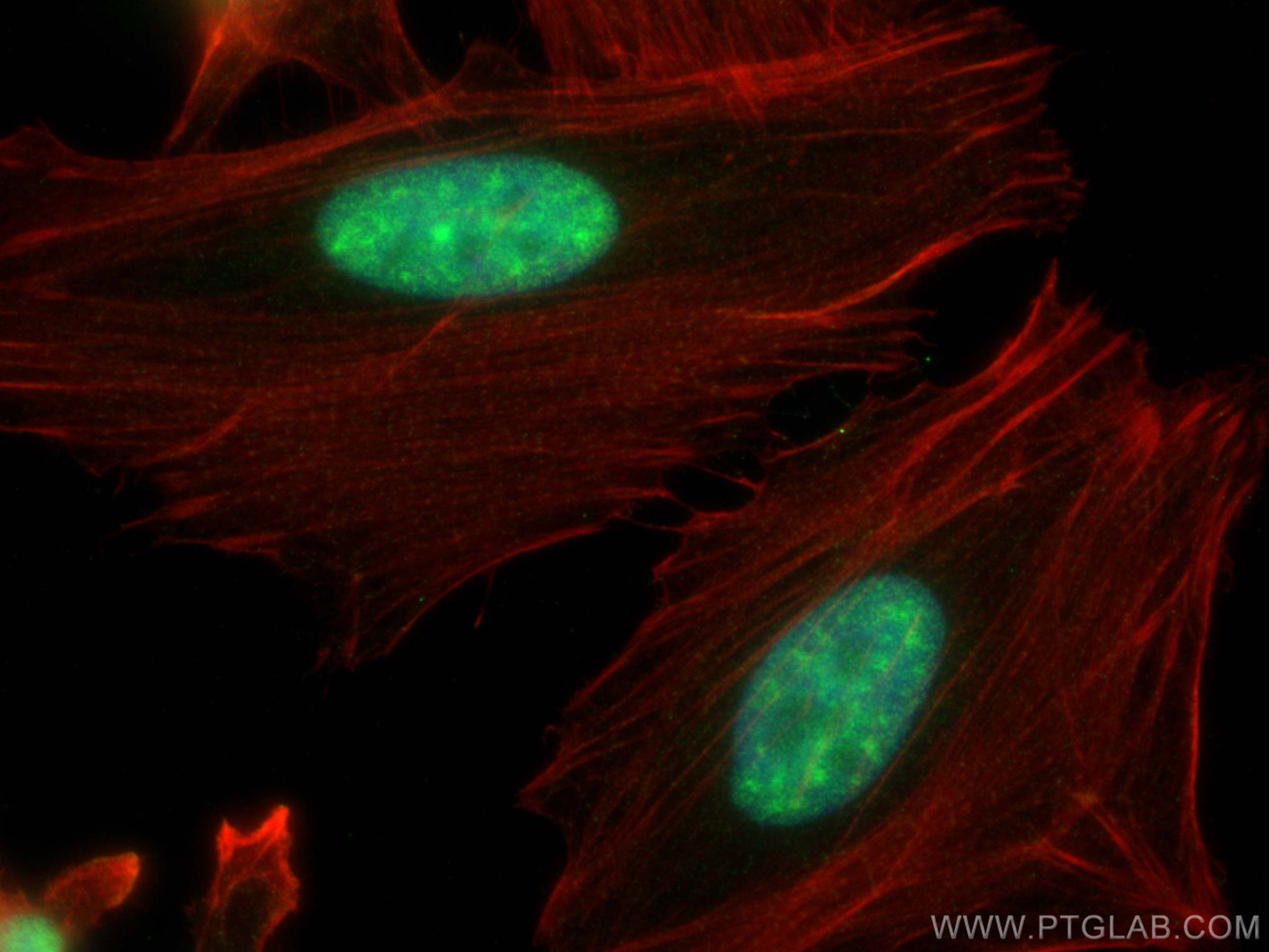 IF Staining of HeLa using 30461-1-AP