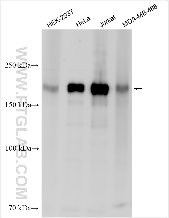 WB analysis using 30461-1-AP