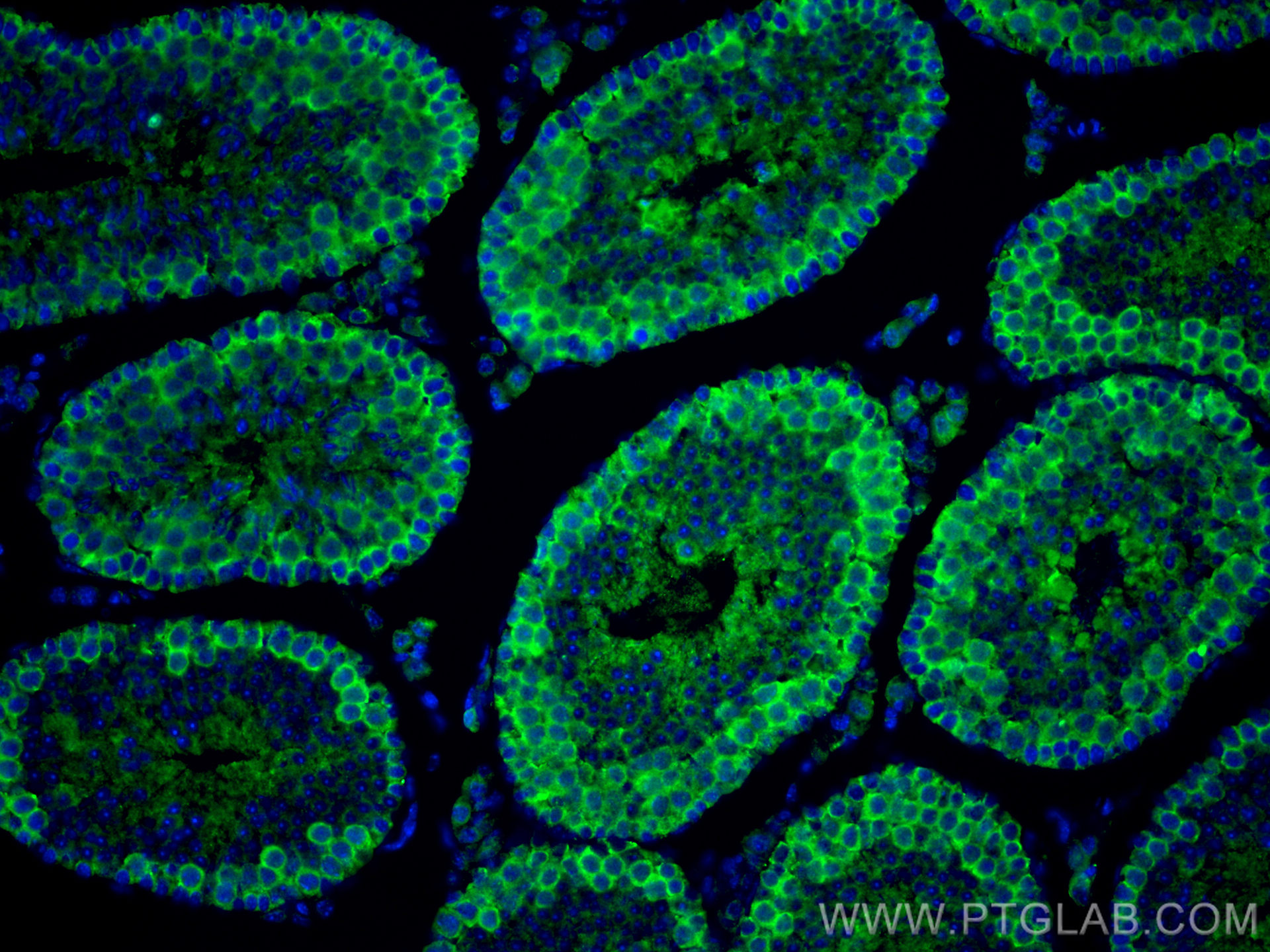 IF Staining of mouse testis using 10122-1-AP