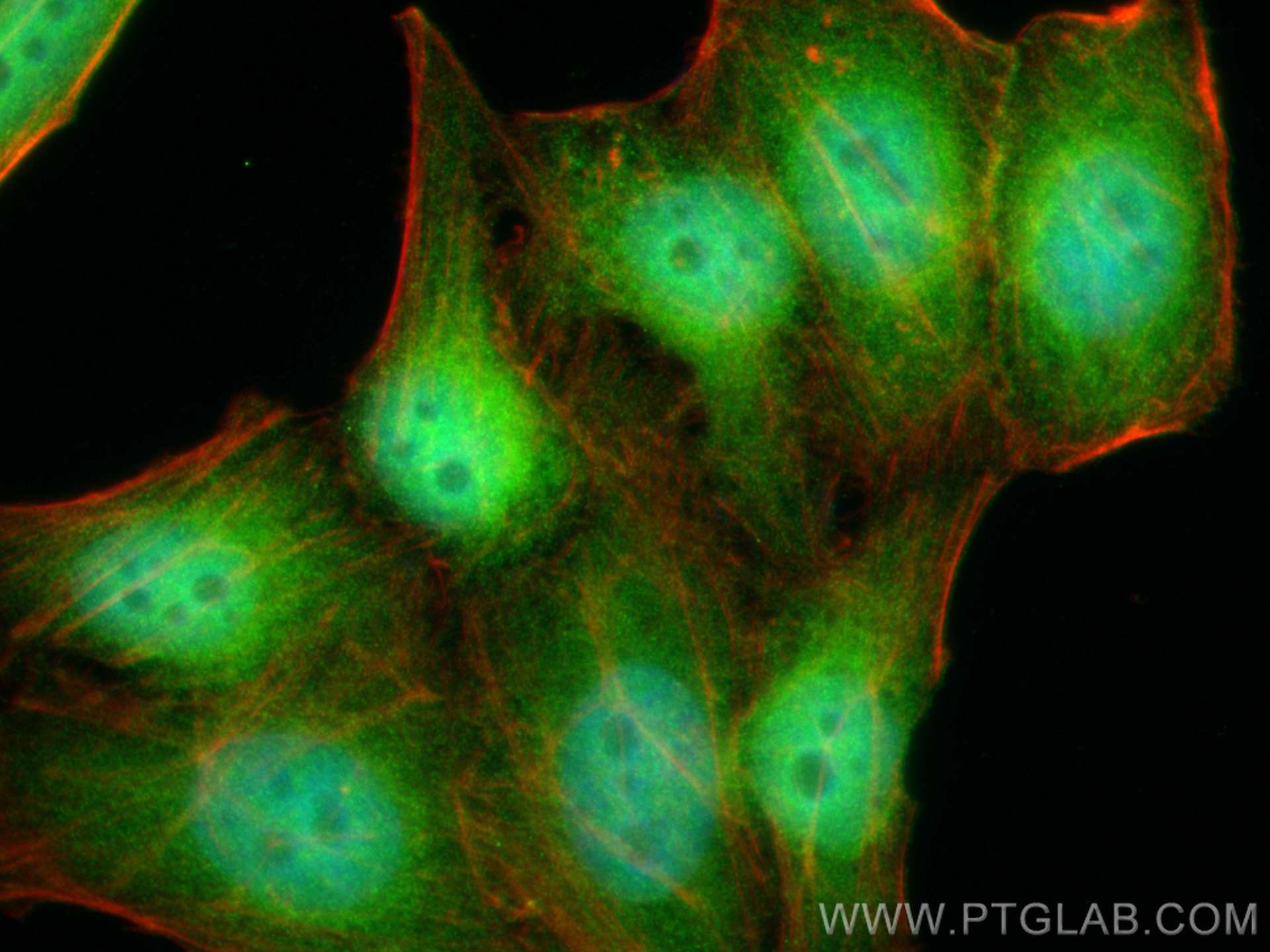 IF Staining of HepG2 using 10122-1-AP