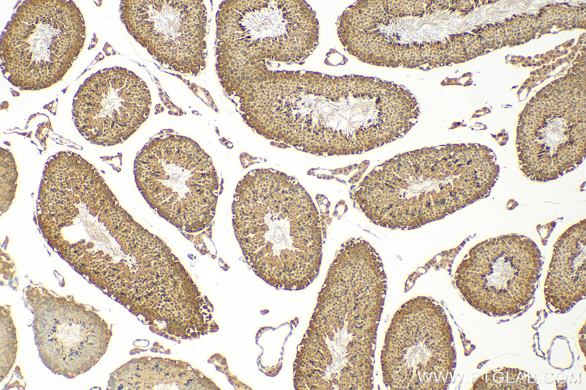 IHC staining of mouse testis using 10122-1-AP