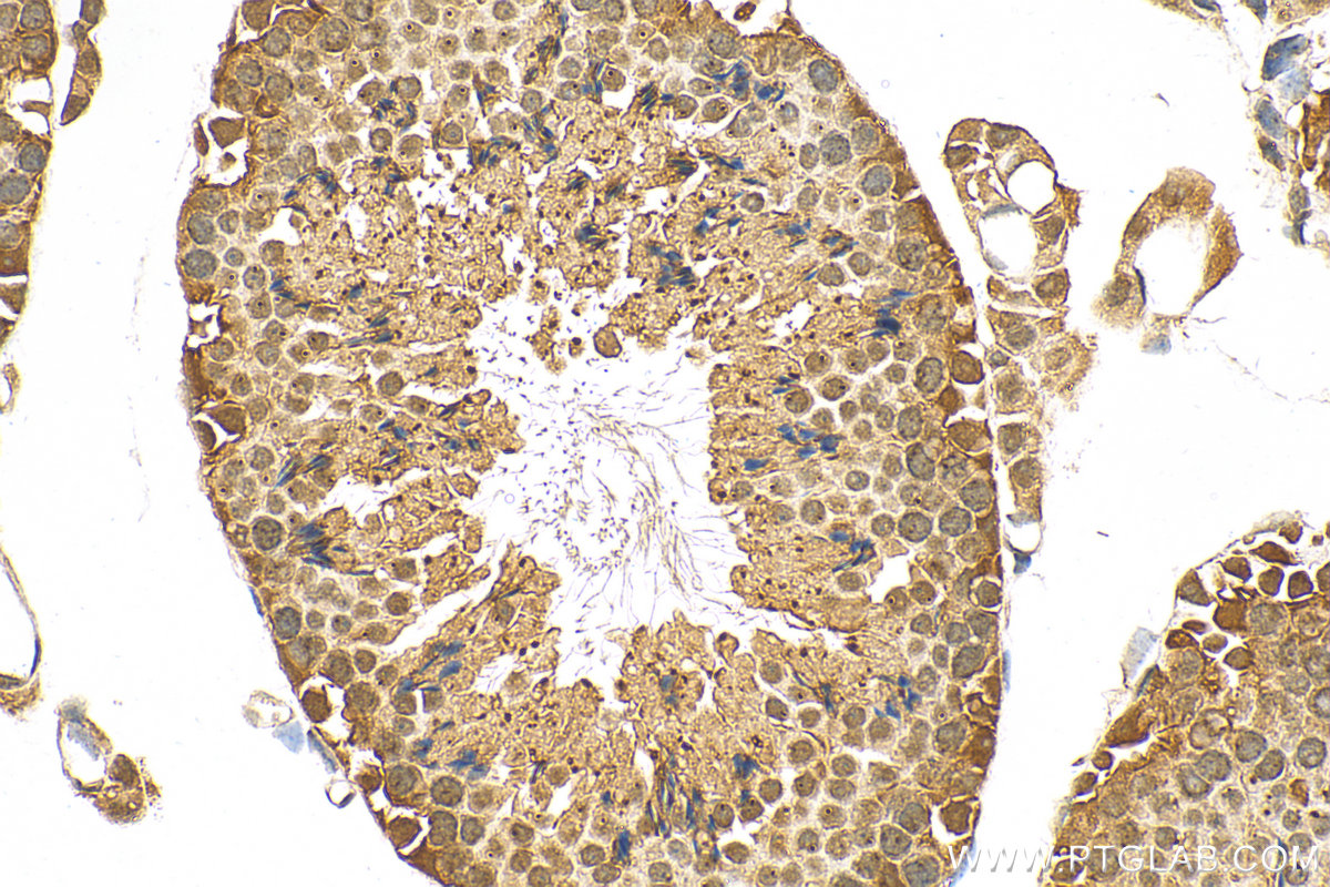 IHC staining of mouse testis using 10122-1-AP