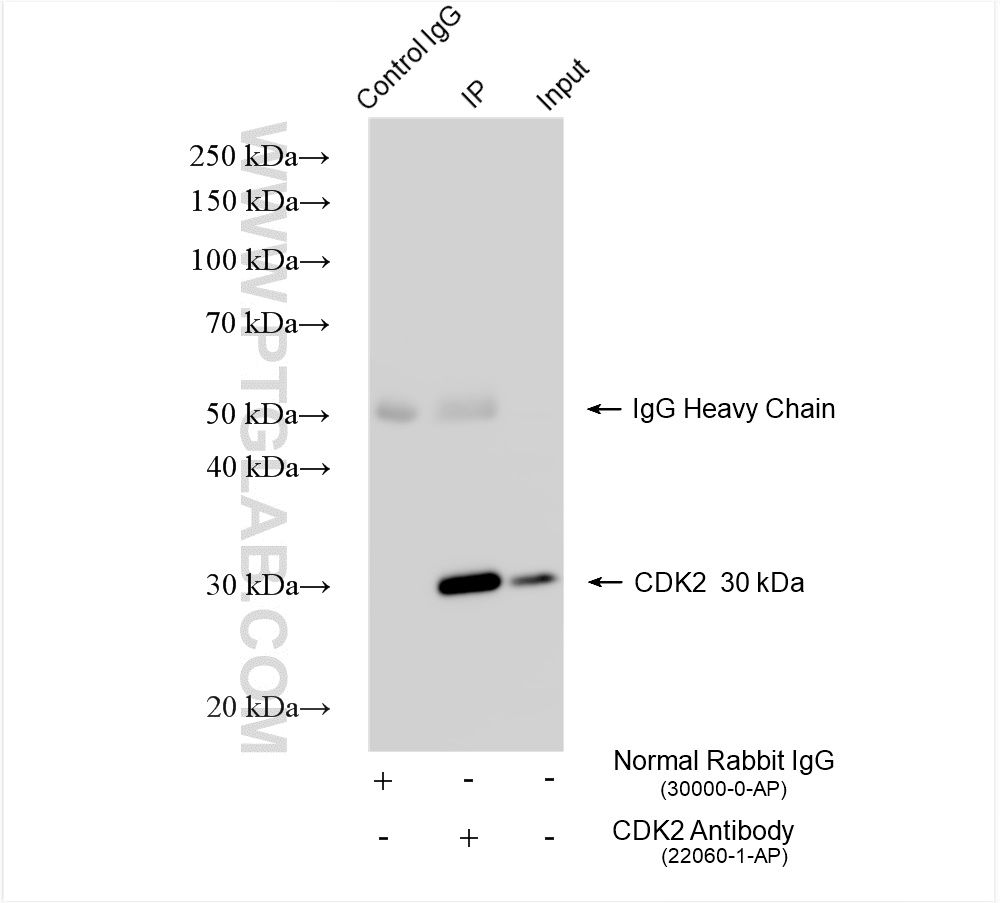 IP experiment of HeLa using 22060-1-AP