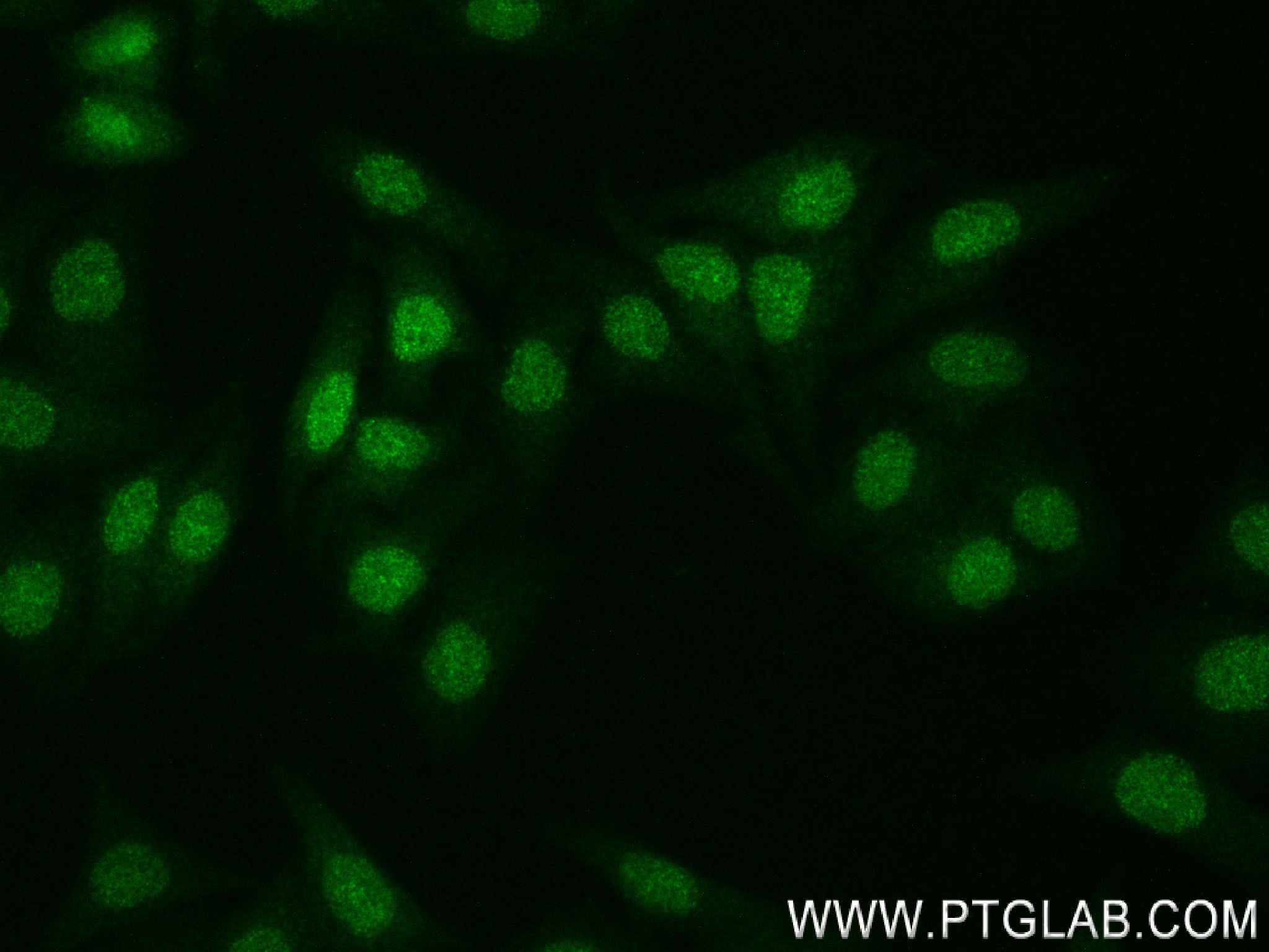 IF Staining of HepG2 using 83635-2-RR