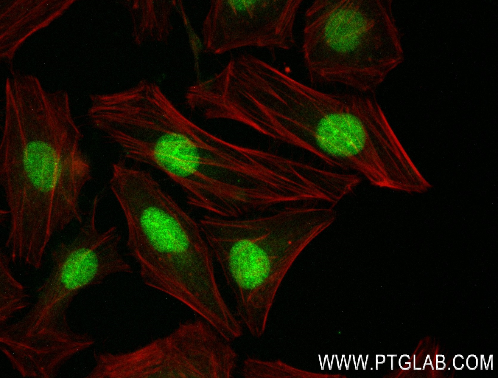 IF Staining of HeLa using 83635-5-RR