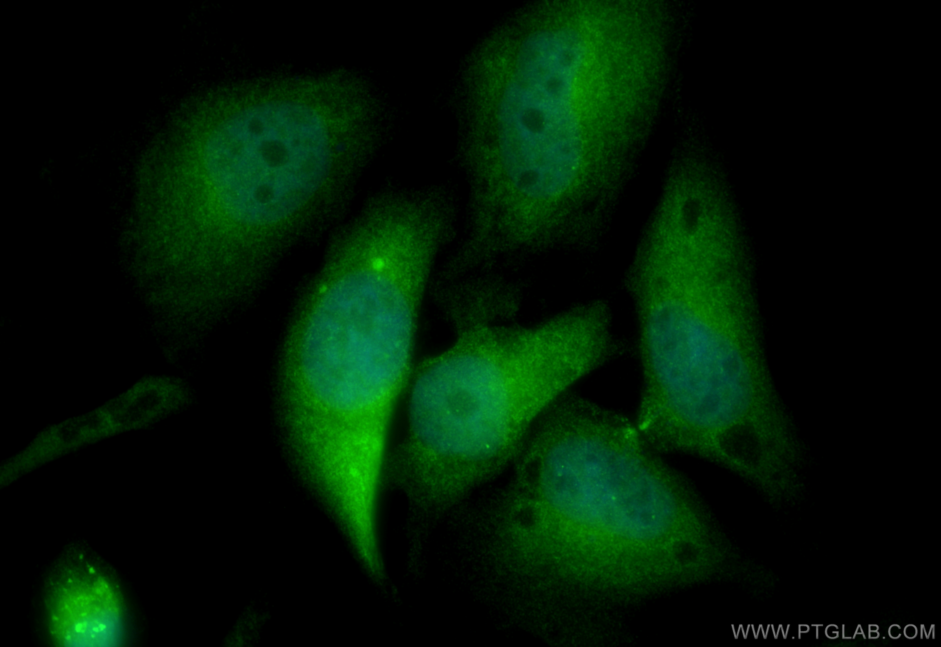 IF Staining of HeLa using 55103-1-AP