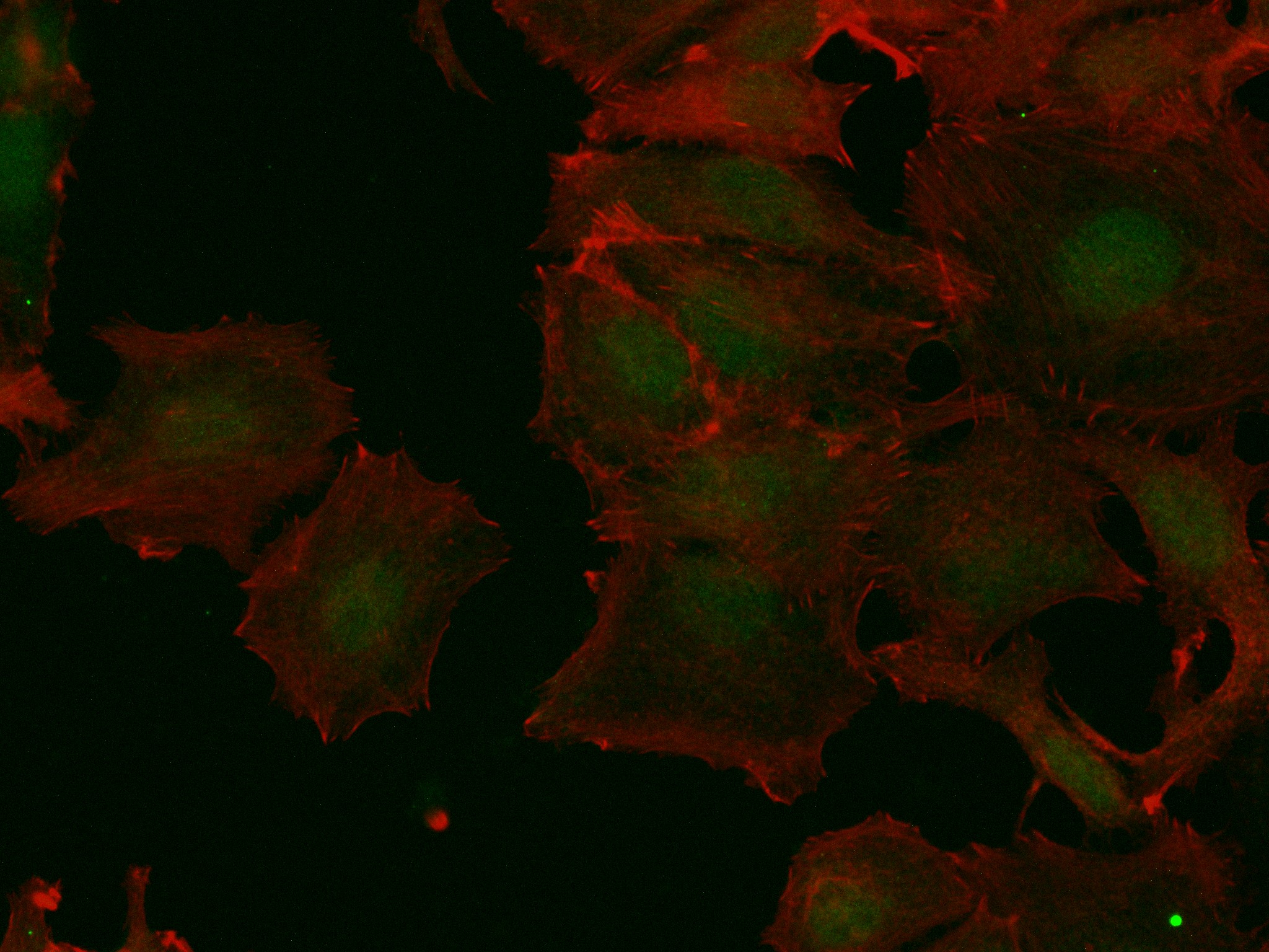 IF Staining of MCF-7 using 83994-3-RR (same clone as 83994-3-PBS)