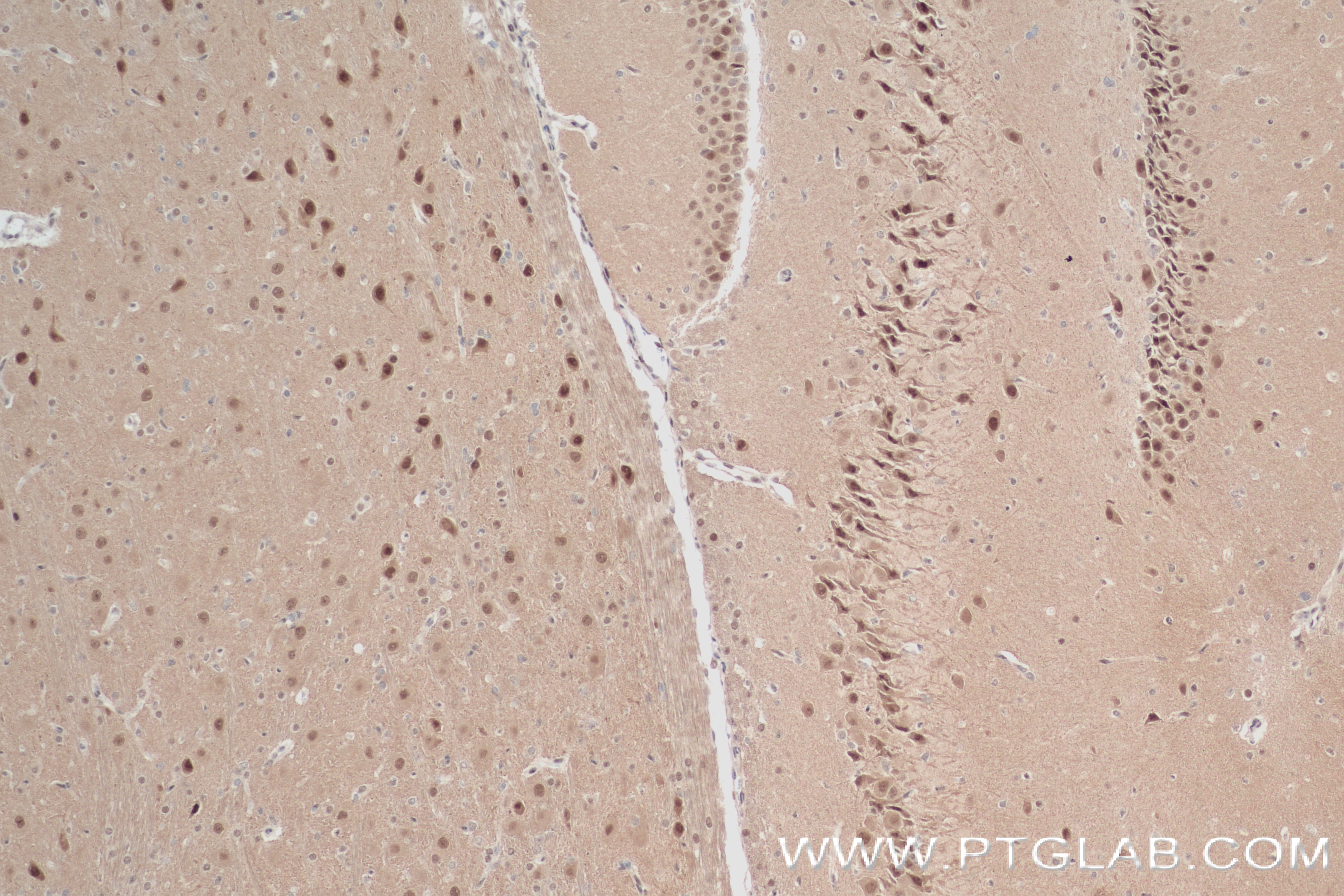 IHC staining of rat brain using 84749-1-RR (same clone as 84749-1-PBS)