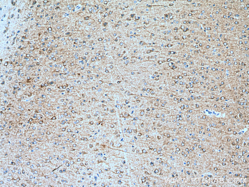 IHC staining of mouse brain using 67503-1-Ig (same clone as 67503-1-PBS)
