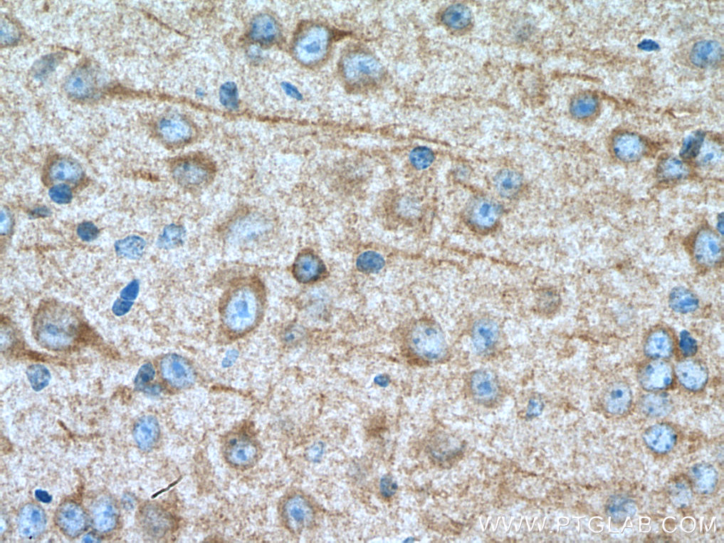 IHC staining of mouse brain using 67503-1-Ig (same clone as 67503-1-PBS)