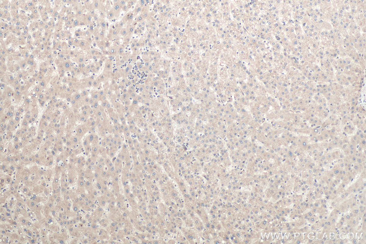 IHC staining of human liver using 11007-1-AP