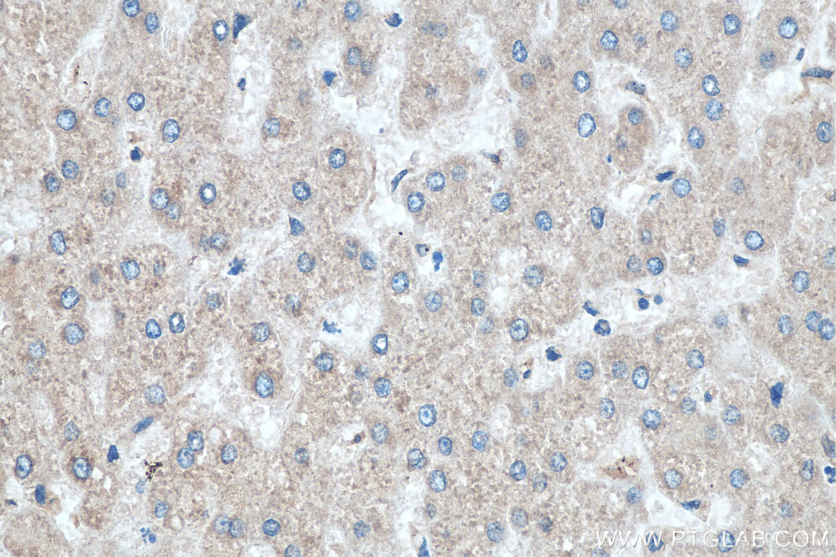 IHC staining of human liver using 11007-1-AP