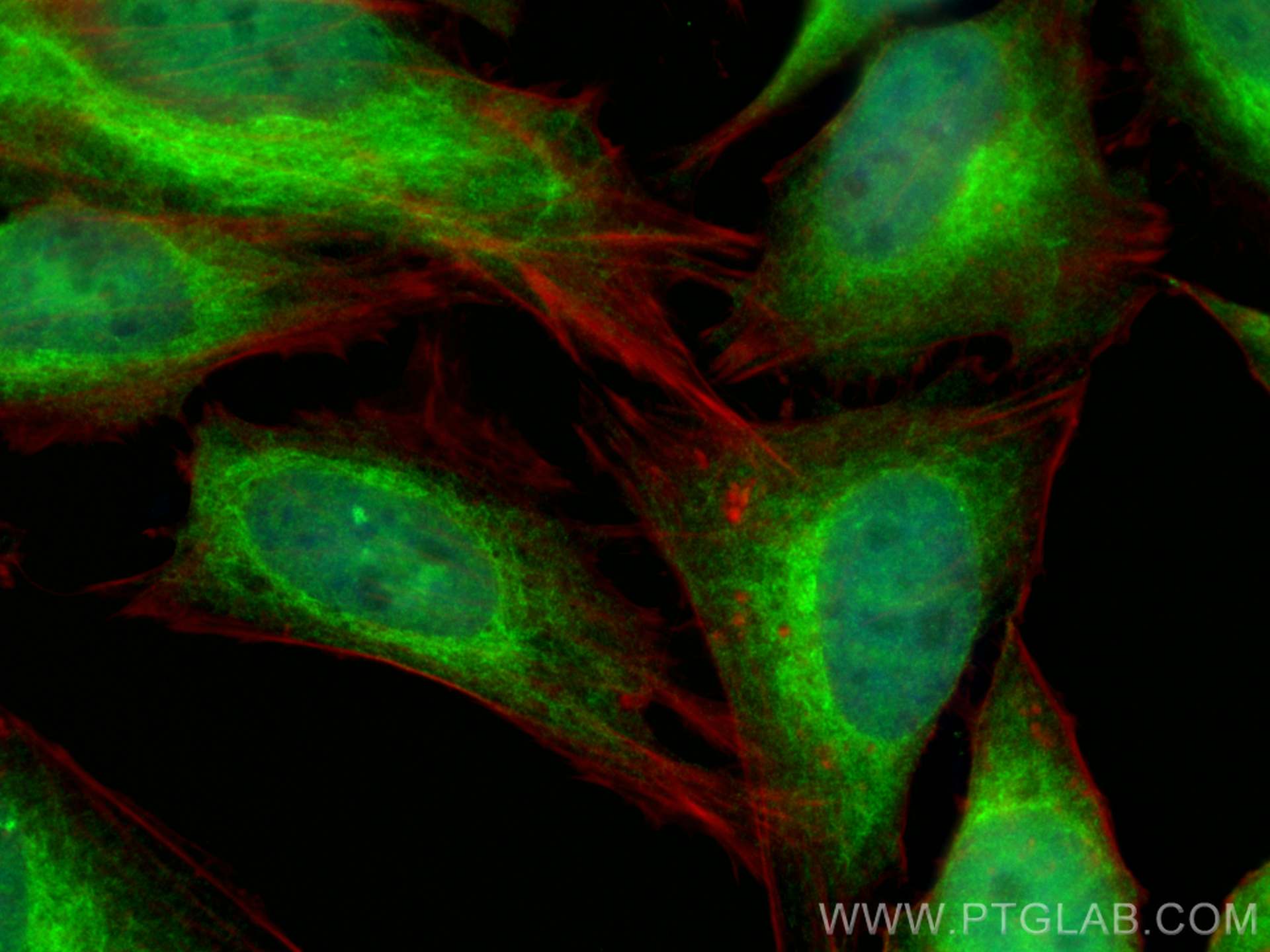 IF Staining of HeLa using 14052-1-AP