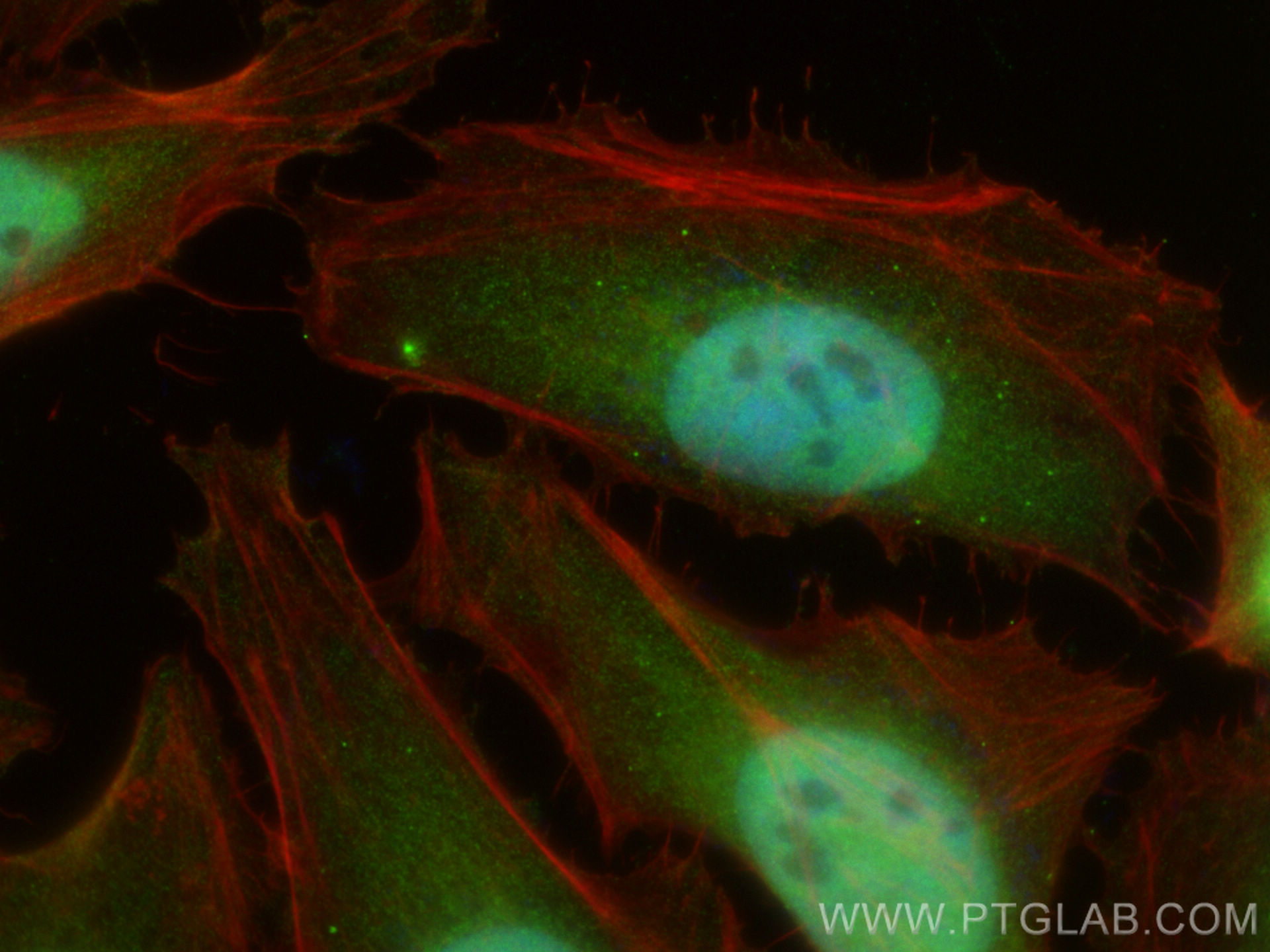 IF Staining of HeLa using 14052-1-AP