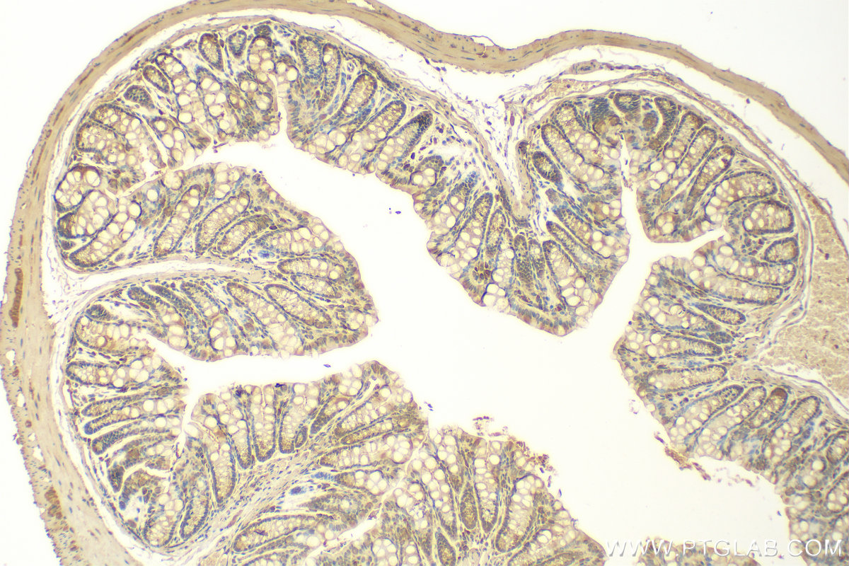 IHC staining of mouse colon using 14052-1-AP