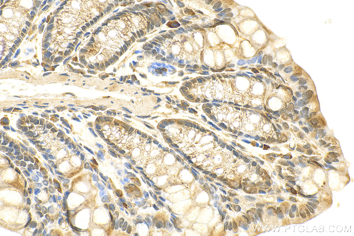 IHC staining of mouse colon using 14052-1-AP