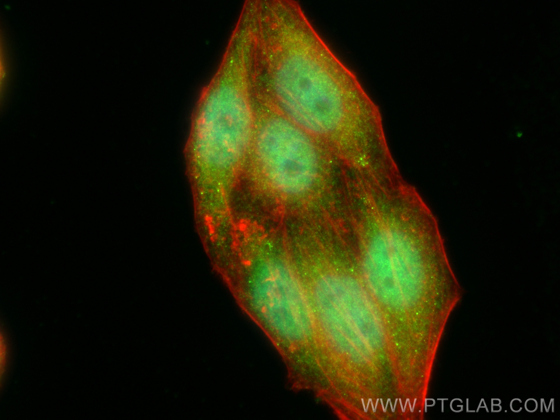 IF Staining of HepG2 using 27027-1-AP