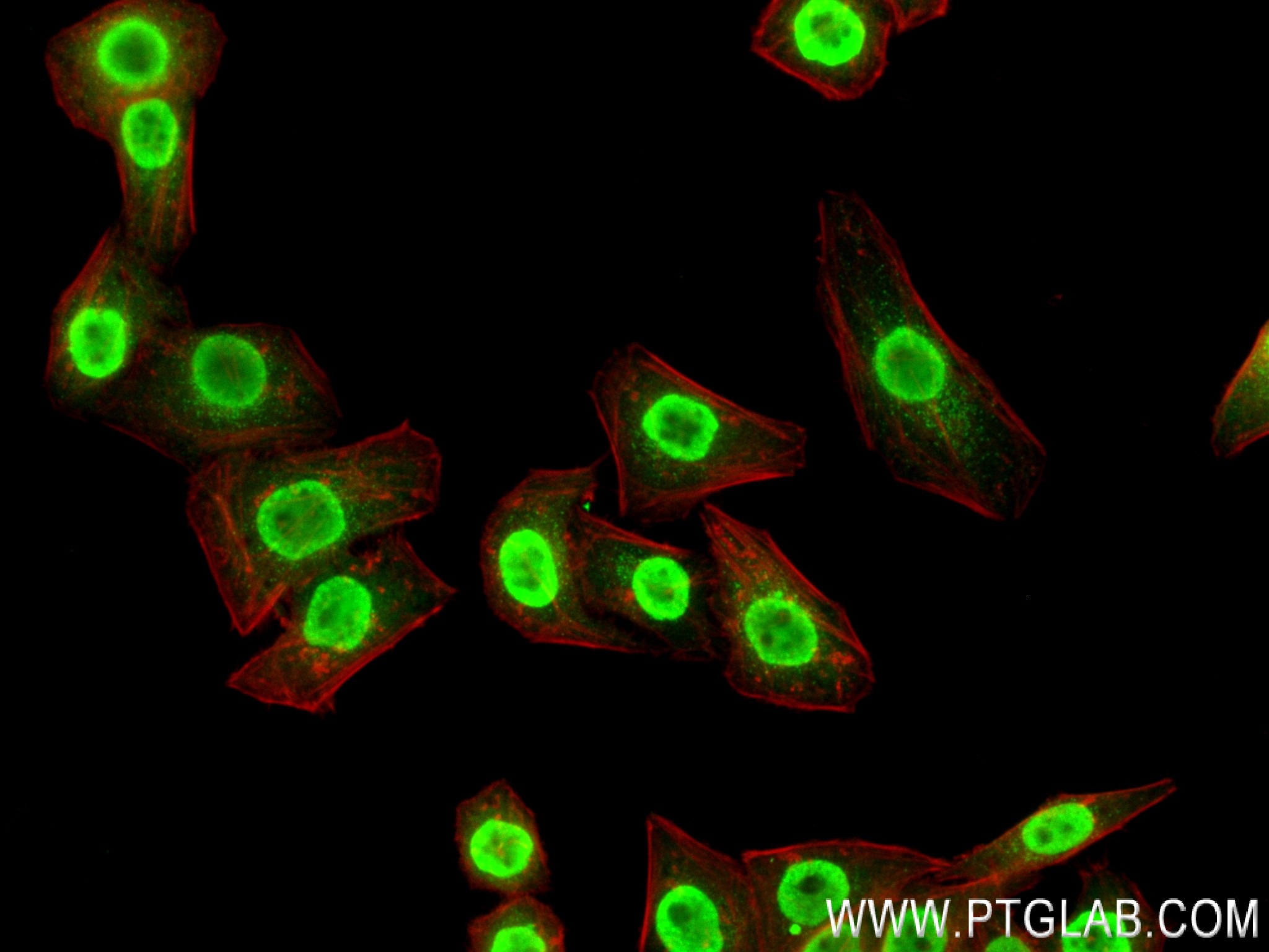 IF Staining of HepG2 using 83621-6-RR (same clone as 83621-6-PBS)