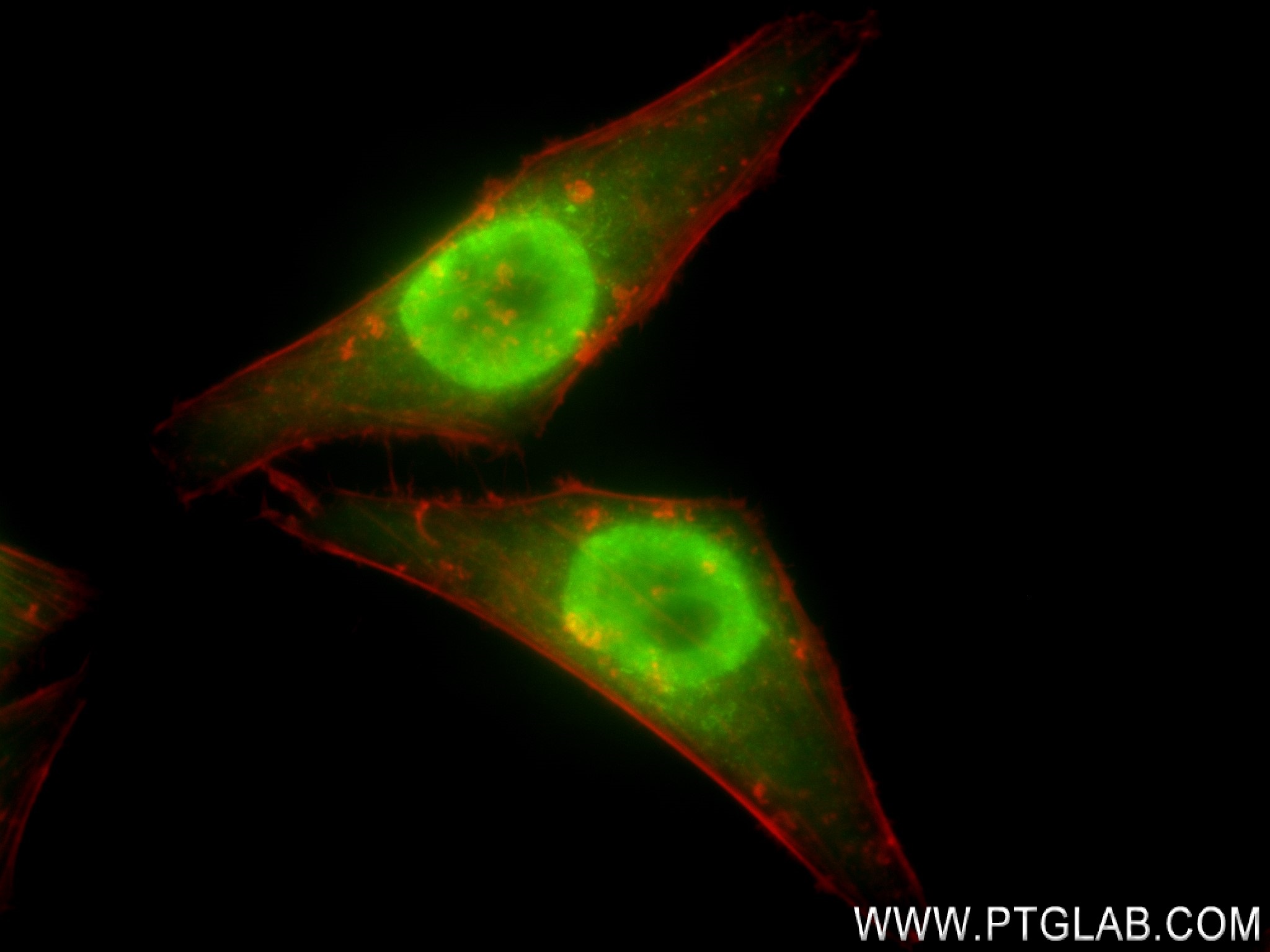 IF Staining of HepG2 using 83621-6-RR