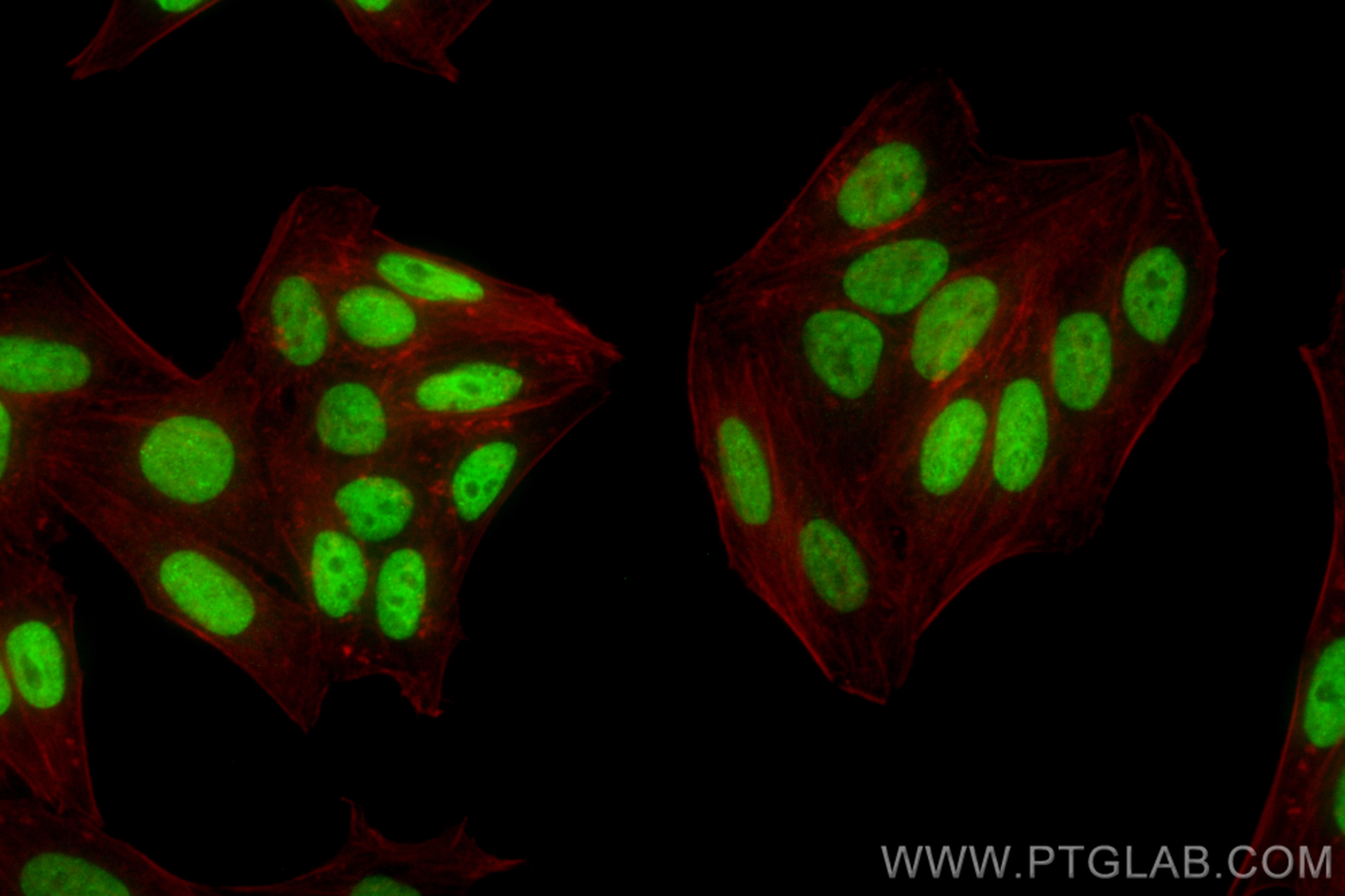 IF Staining of HepG2 using CL488-83621-6