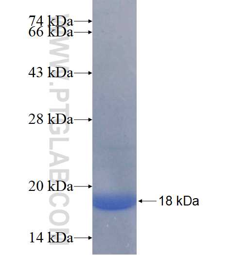 CDK8 fusion protein Ag17148 SDS-PAGE
